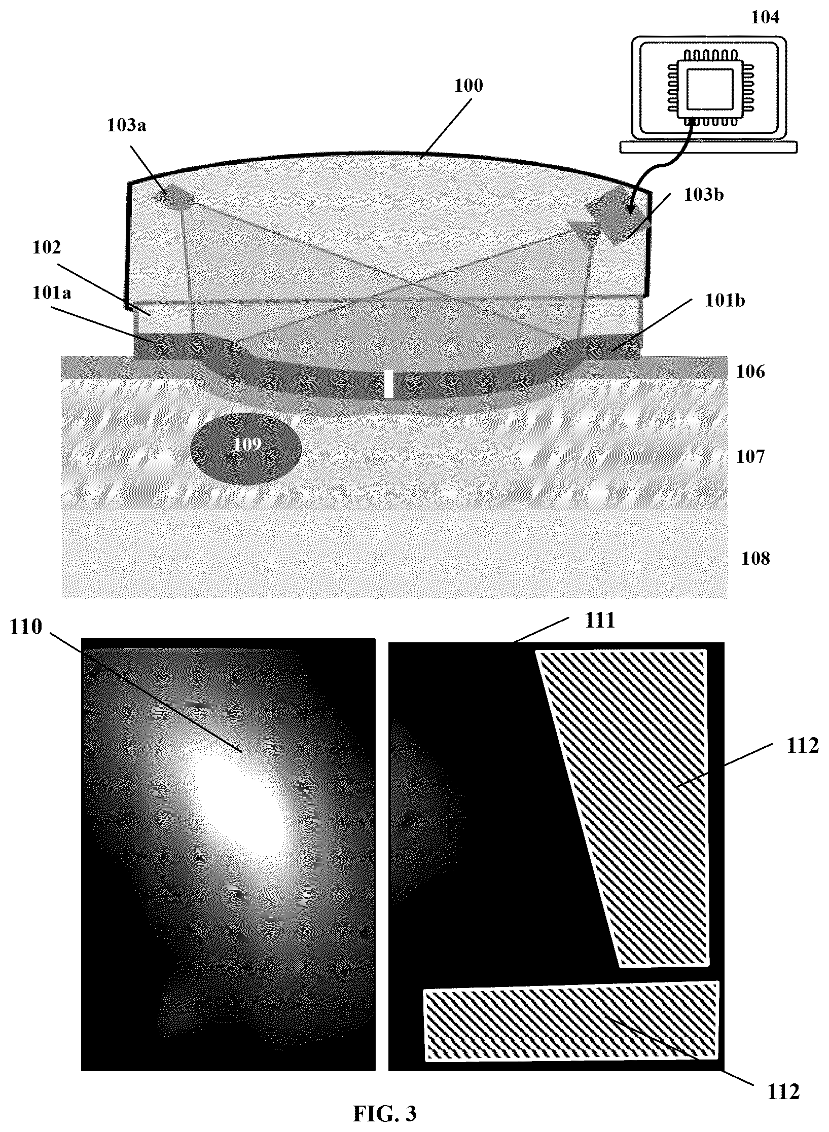 Patent US12599340 Figure 3 – Spatiotemporal-based detection and correction of motion artifact for measurement of arterial pressure waveform