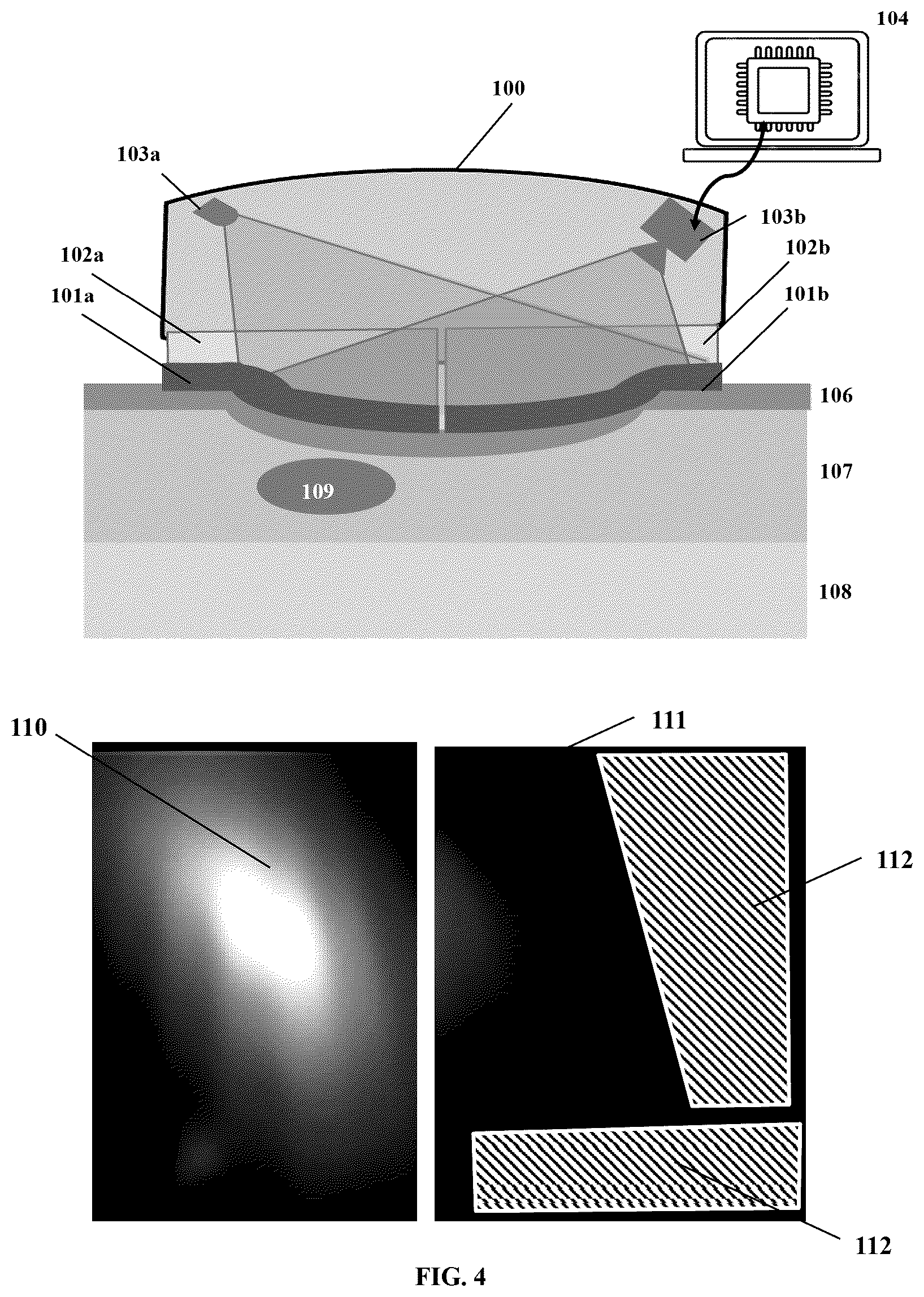 Patent US12599340 Figure 4 – Spatiotemporal-based detection and correction of motion artifact for measurement of arterial pressure waveform
