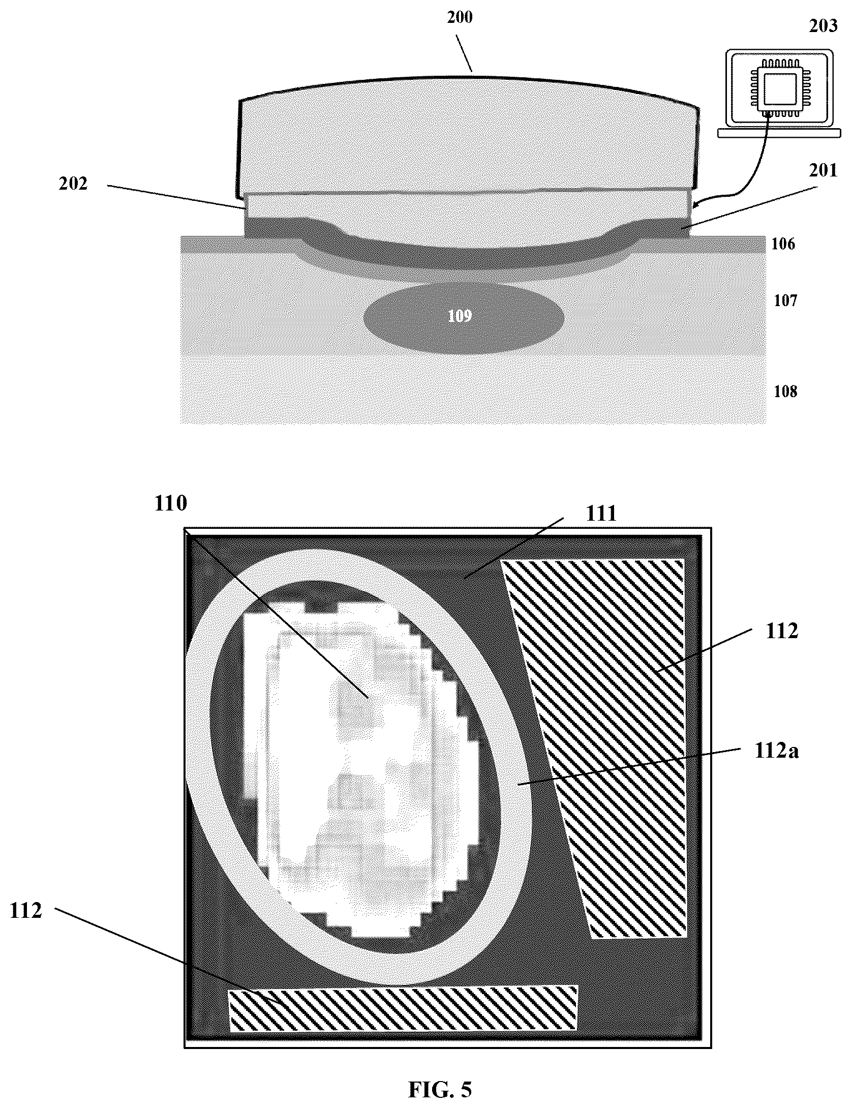 Patent US12599340 Figure 5 – Spatiotemporal-based detection and correction of motion artifact for measurement of arterial pressure waveform
