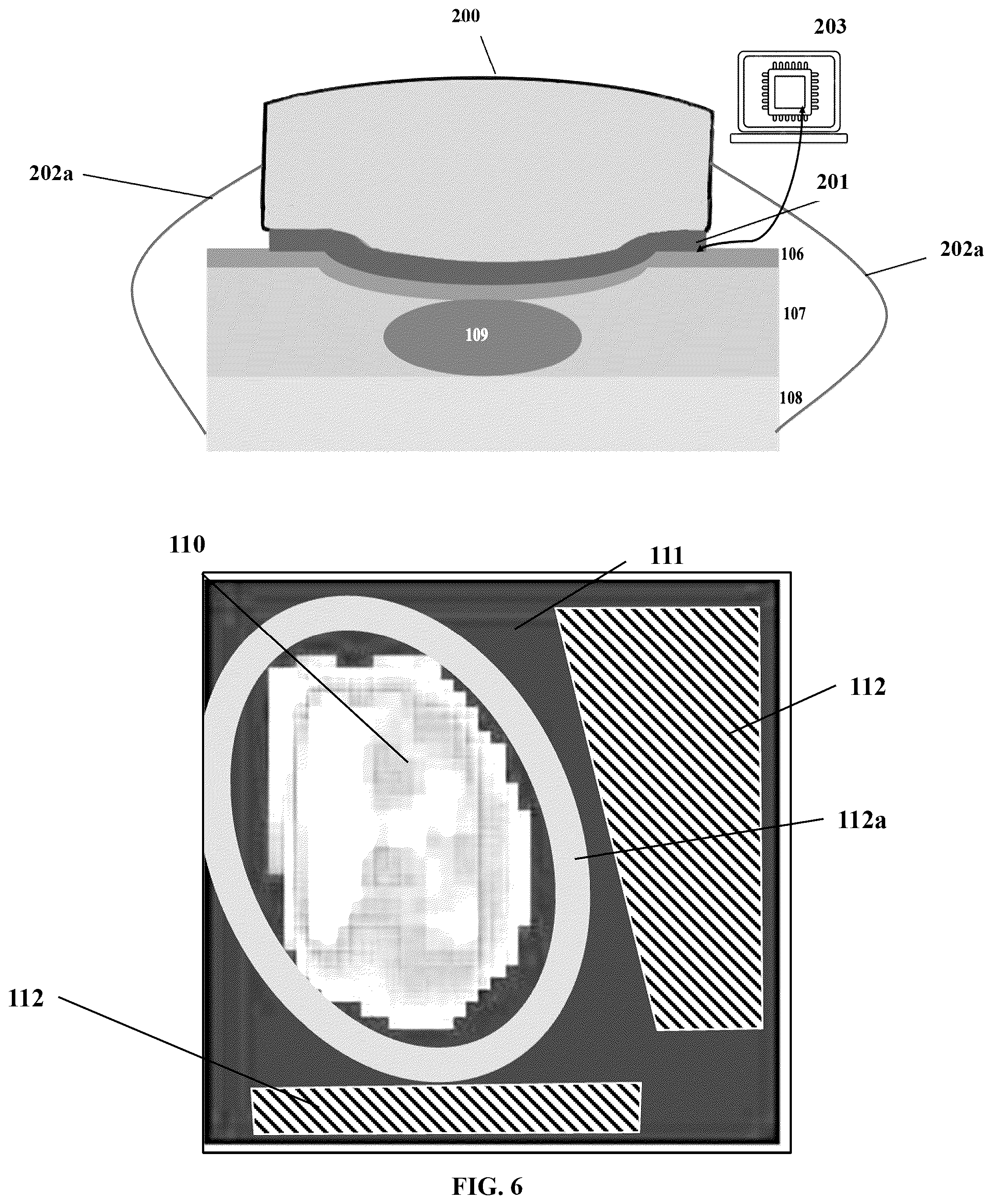 Patent US12599340 Figure 6 – Spatiotemporal-based detection and correction of motion artifact for measurement of arterial pressure waveform
