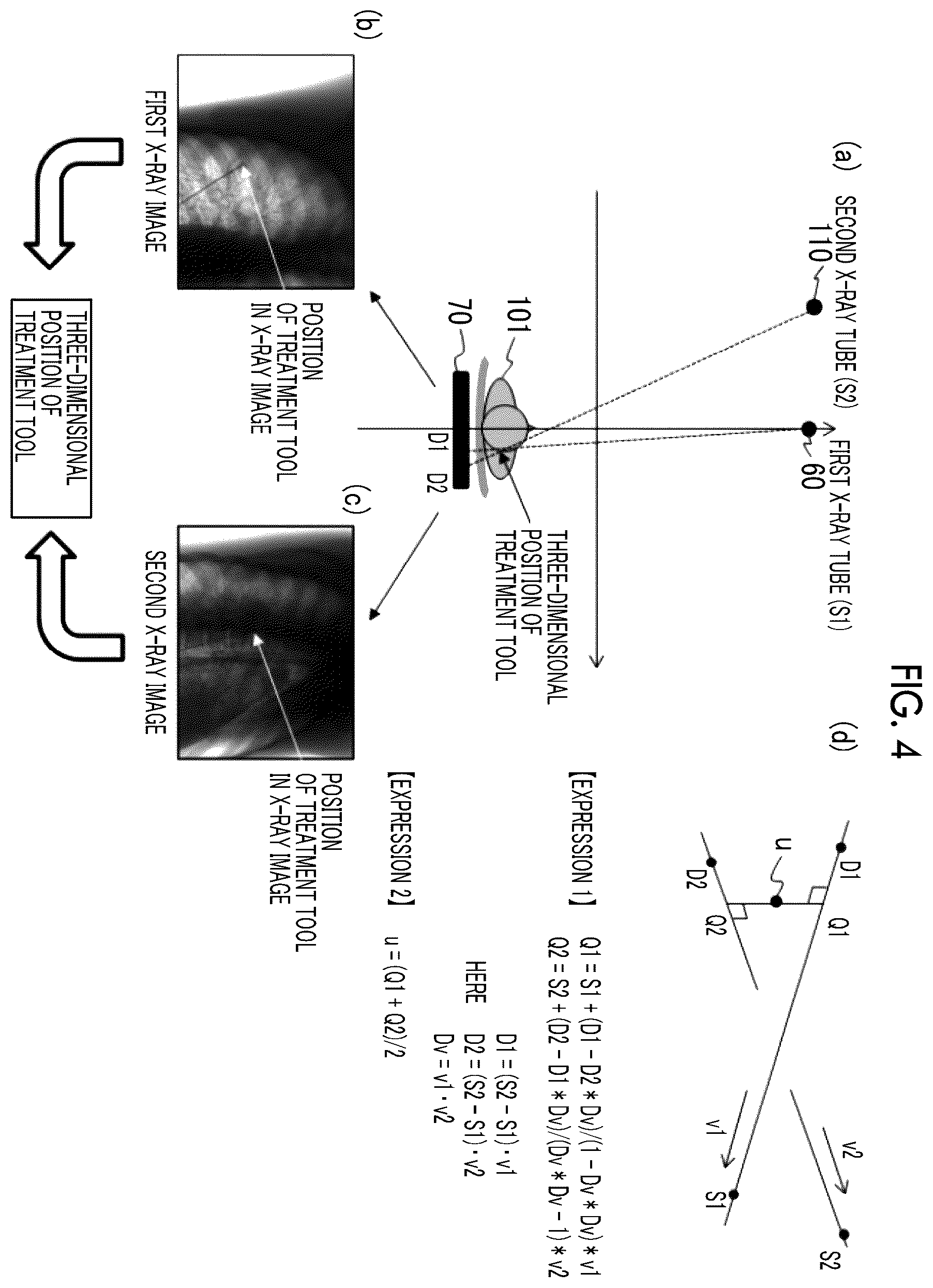 Patent US12599347 Figure 4 – X-ray imaging apparatus and x-ray imaging method