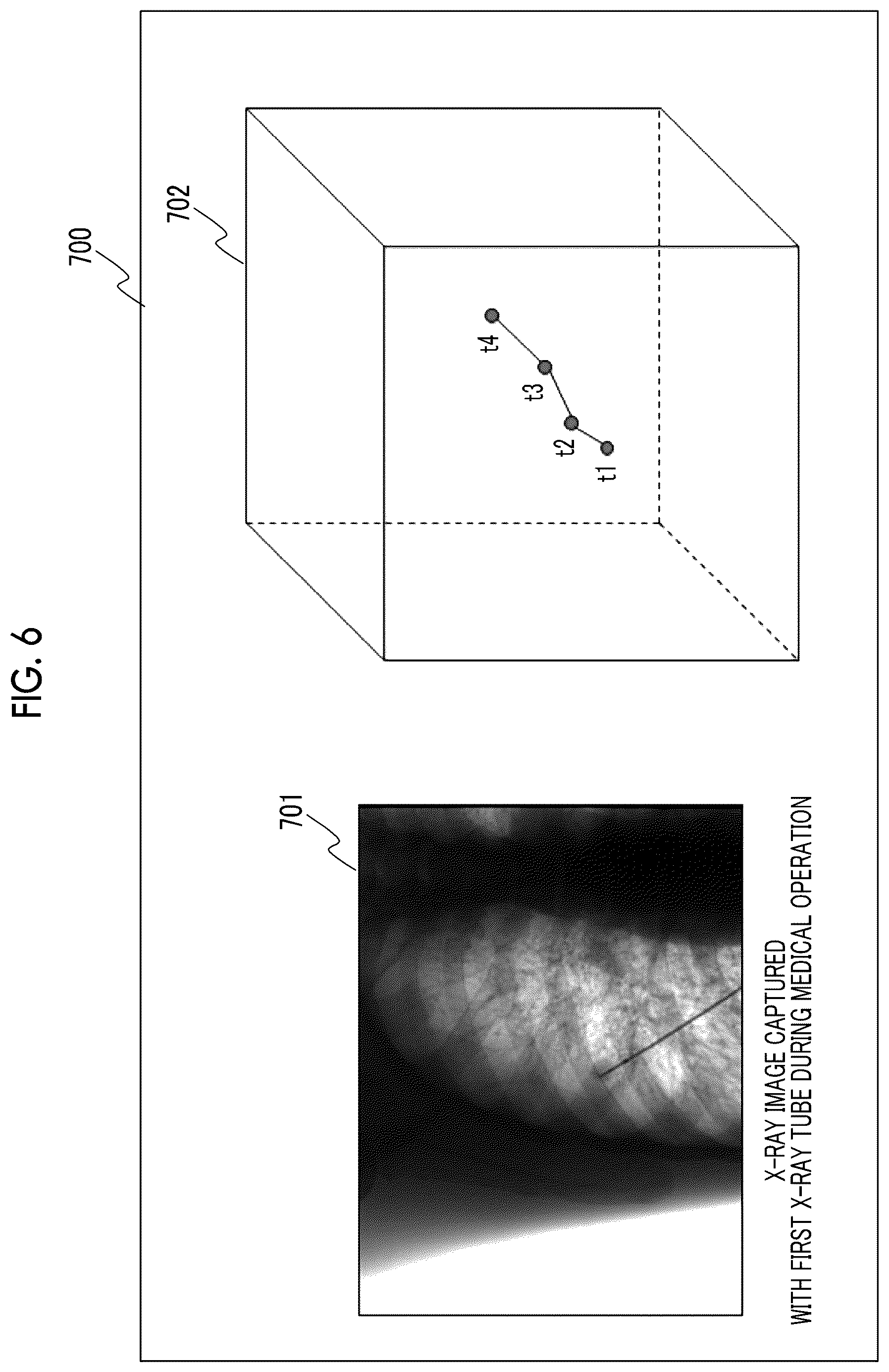 Patent US12599347 Figure 6 – X-ray imaging apparatus and x-ray imaging method