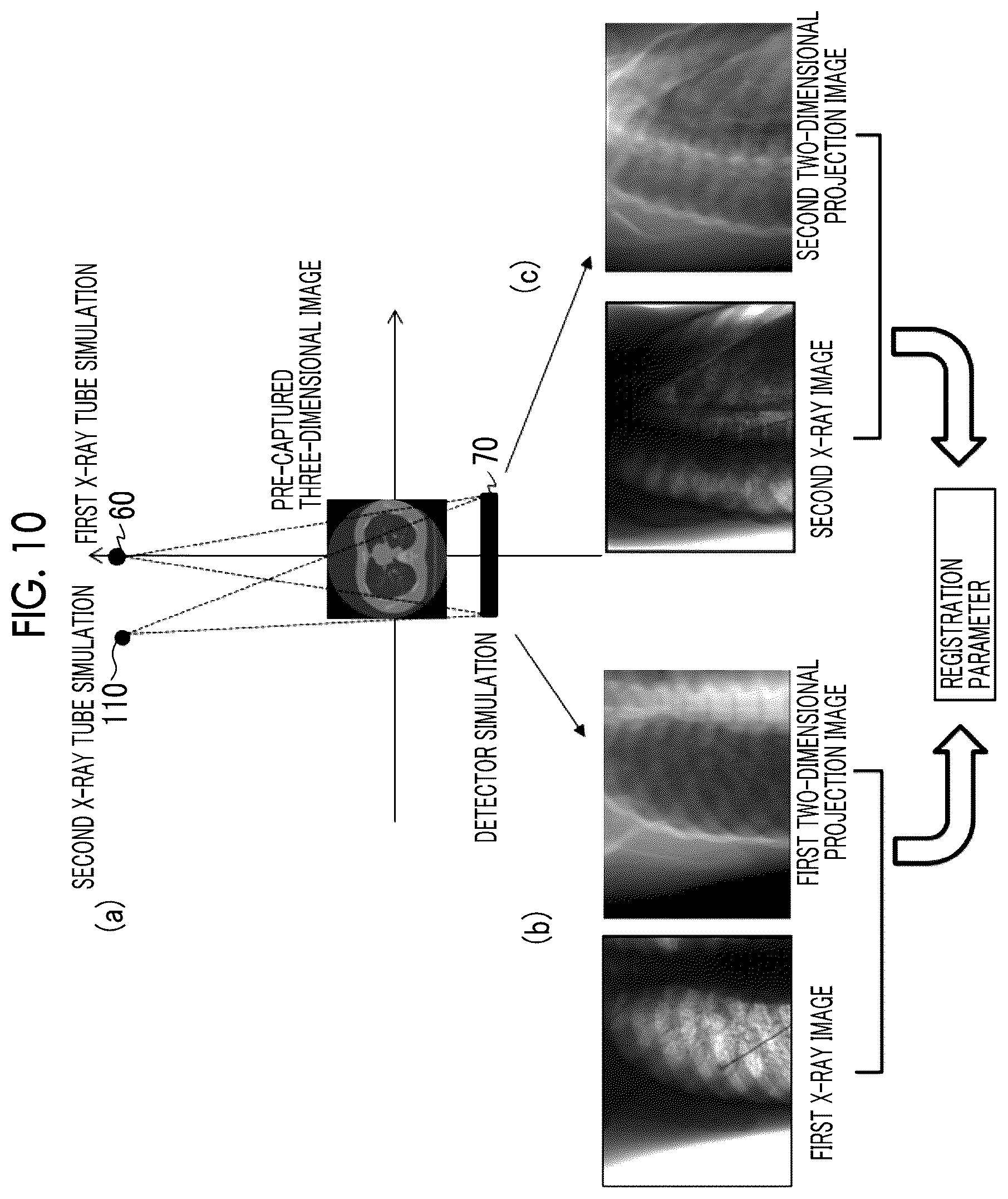 Patent US12599347 Figure 10 – X-ray imaging apparatus and x-ray imaging method