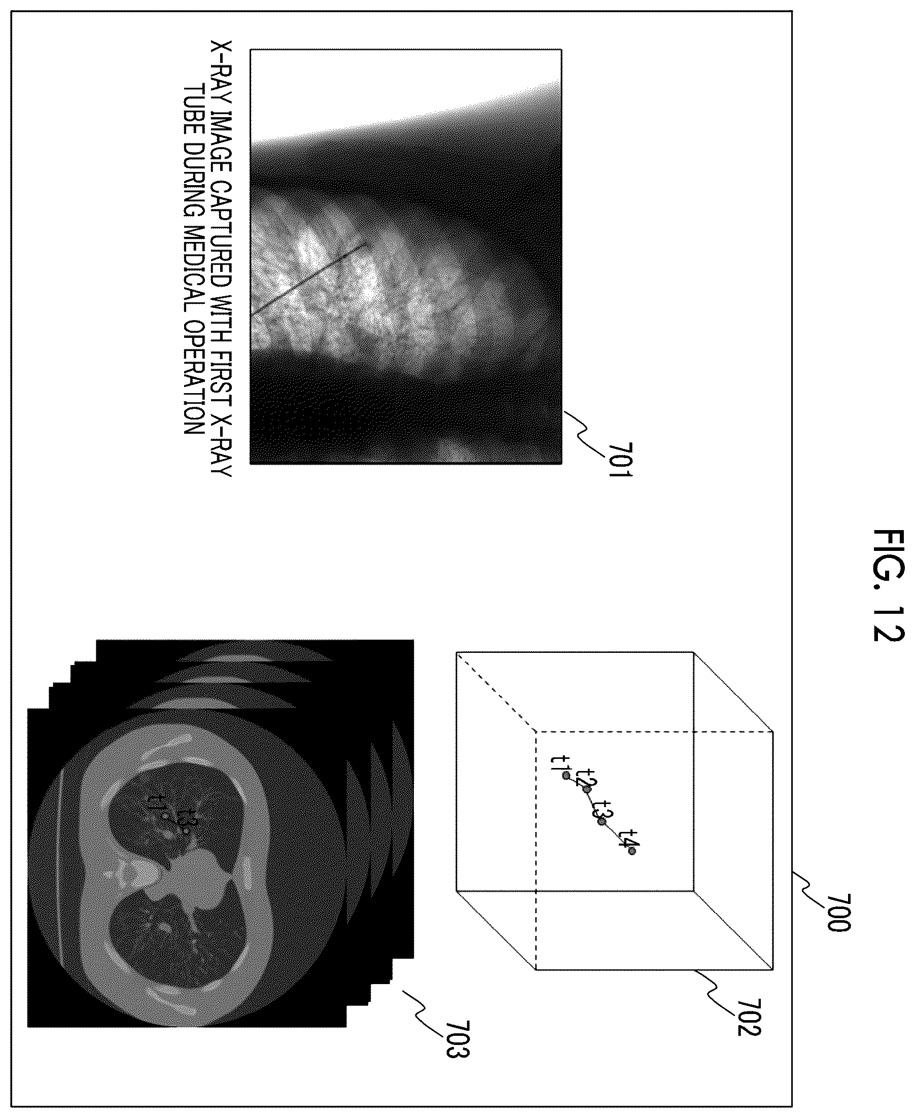 Patent US12599347 Figure 12 – X-ray imaging apparatus and x-ray imaging method
