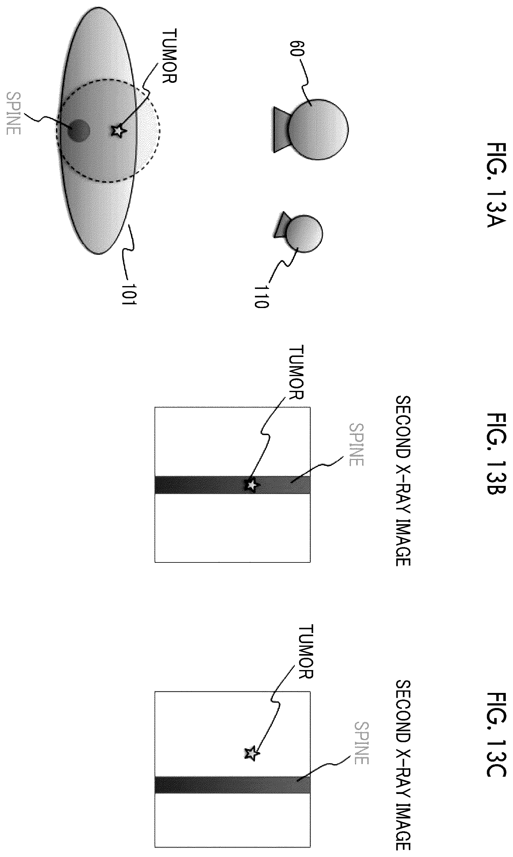 Patent US12599347 Figure 13 – X-ray imaging apparatus and x-ray imaging method