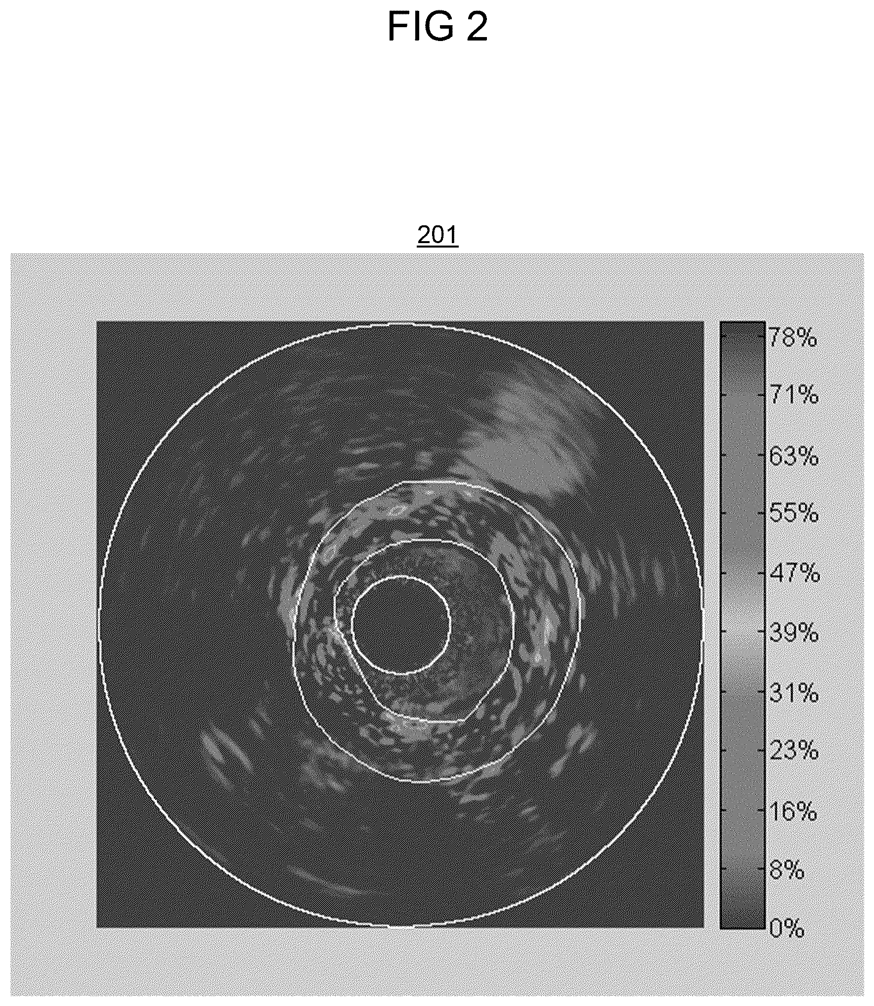 Patent US12599350 Figure 2 – Computed tomography based imaging of vasa vasorum density for detection and monitoring of inflammation and angiogenesis in vascular wall