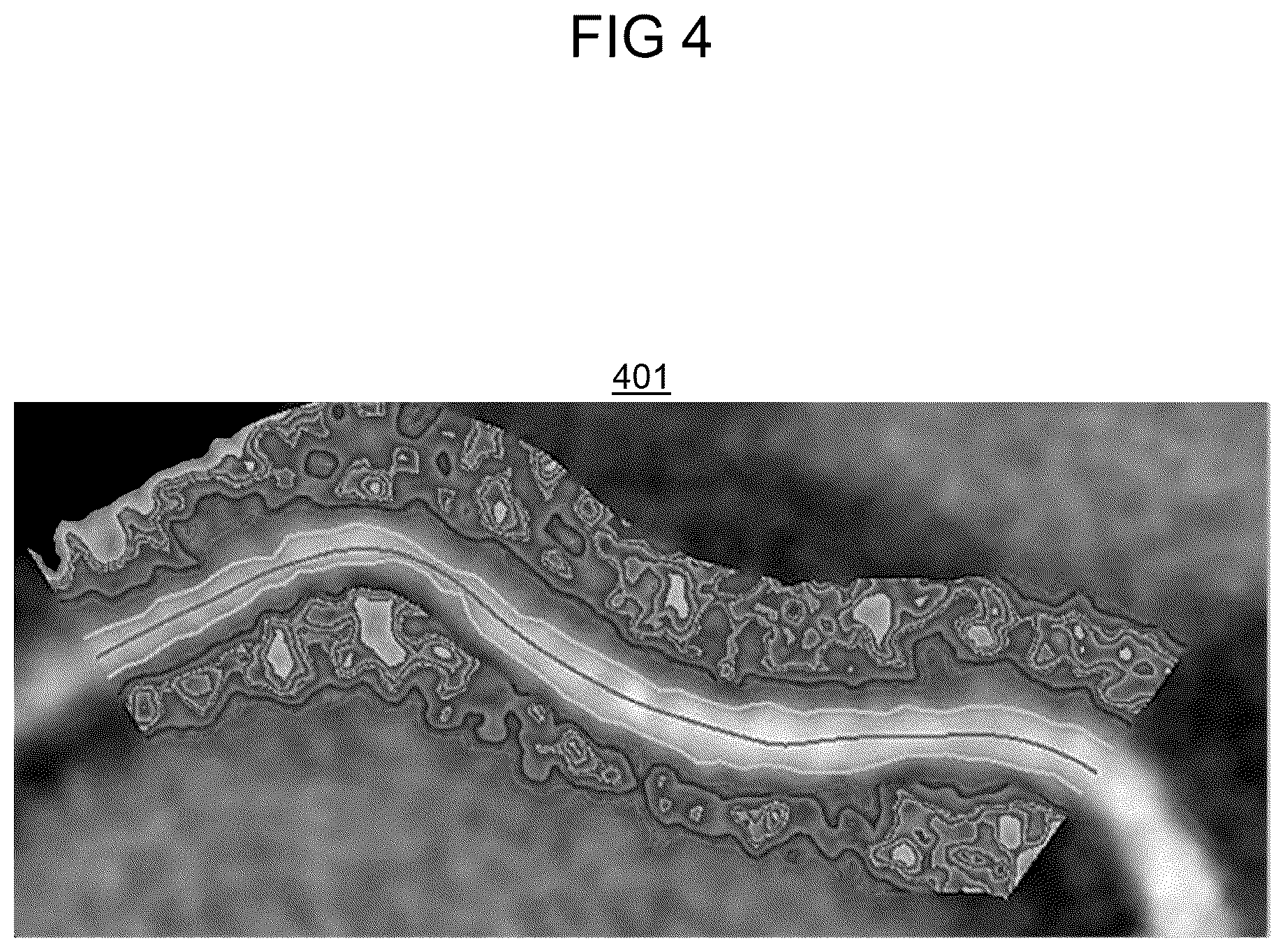 Patent US12599350 Figure 4 – Computed tomography based imaging of vasa vasorum density for detection and monitoring of inflammation and angiogenesis in vascular wall