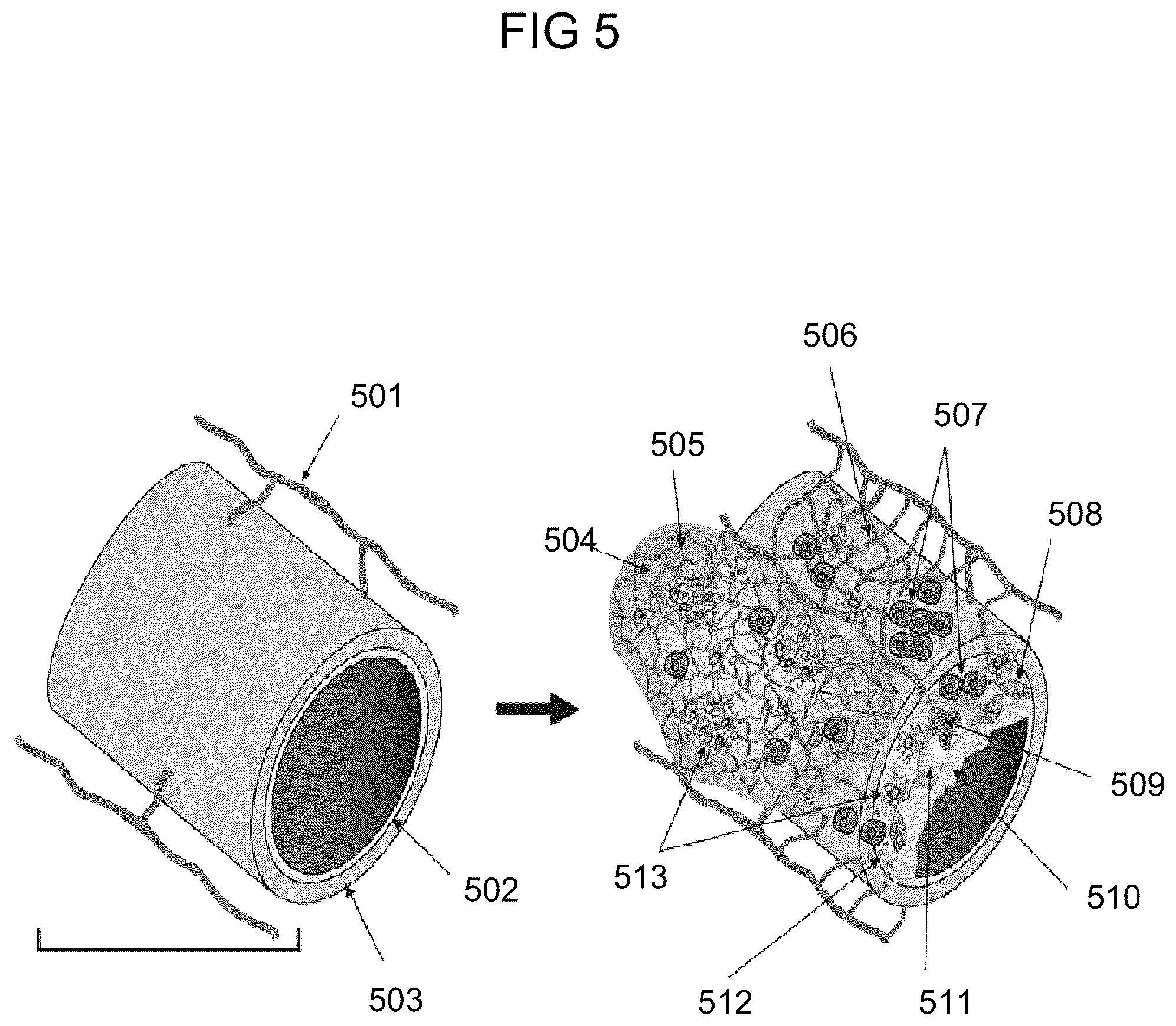 Patent US12599350 Figure 5 – Computed tomography based imaging of vasa vasorum density for detection and monitoring of inflammation and angiogenesis in vascular wall