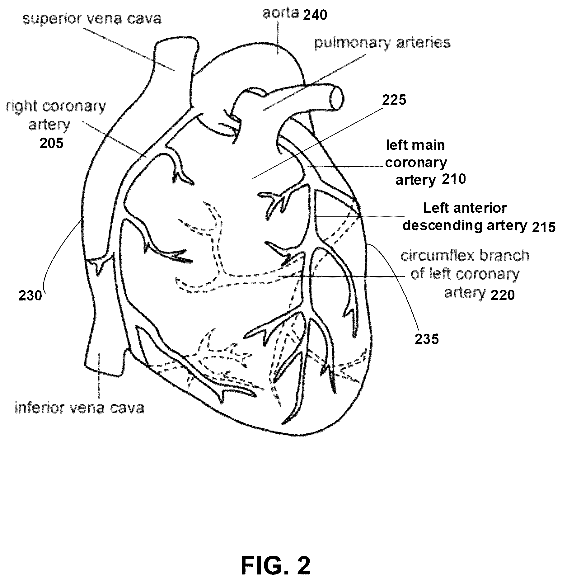 Patent US12599352 Figure 2 – Systems, devices, and methods for non-invasive image-based plaque analysis and risk determination