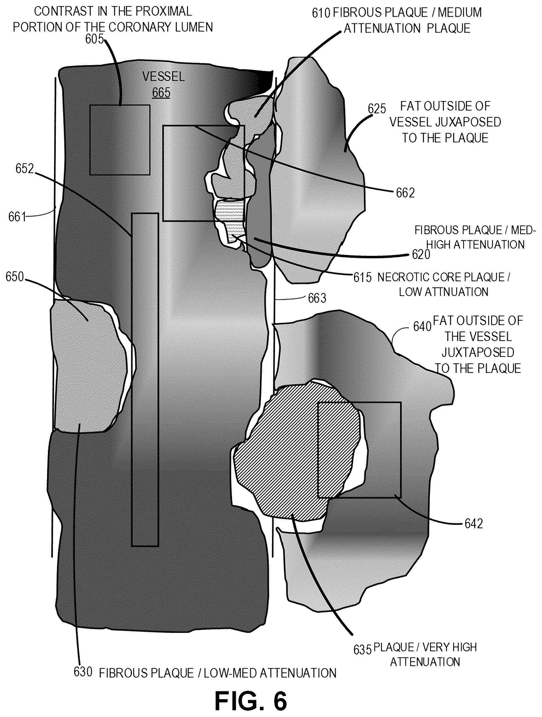 Patent US12599352 Figure 8 – Systems, devices, and methods for non-invasive image-based plaque analysis and risk determination