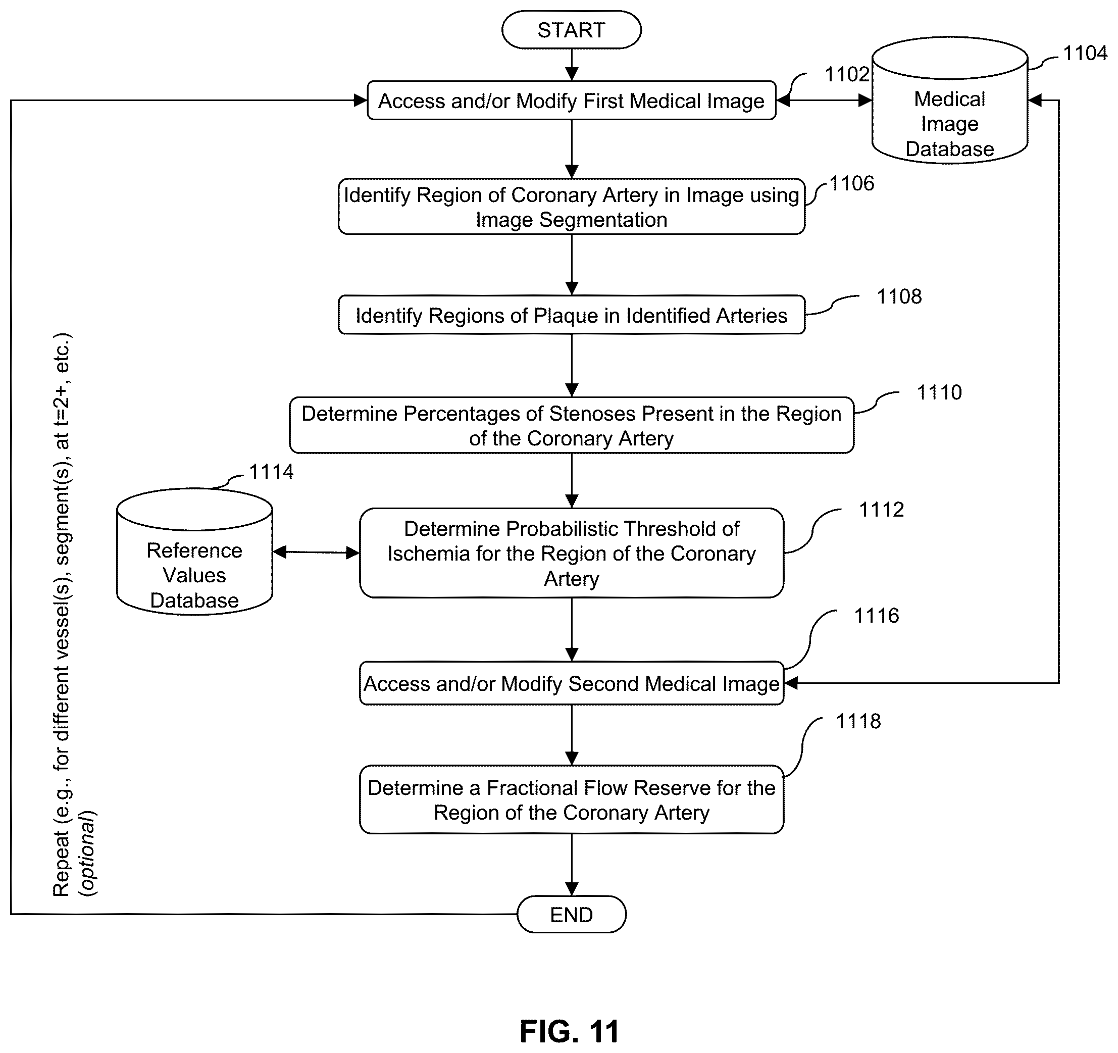 Patent US12599352 Figure 16 – Systems, devices, and methods for non-invasive image-based plaque analysis and risk determination