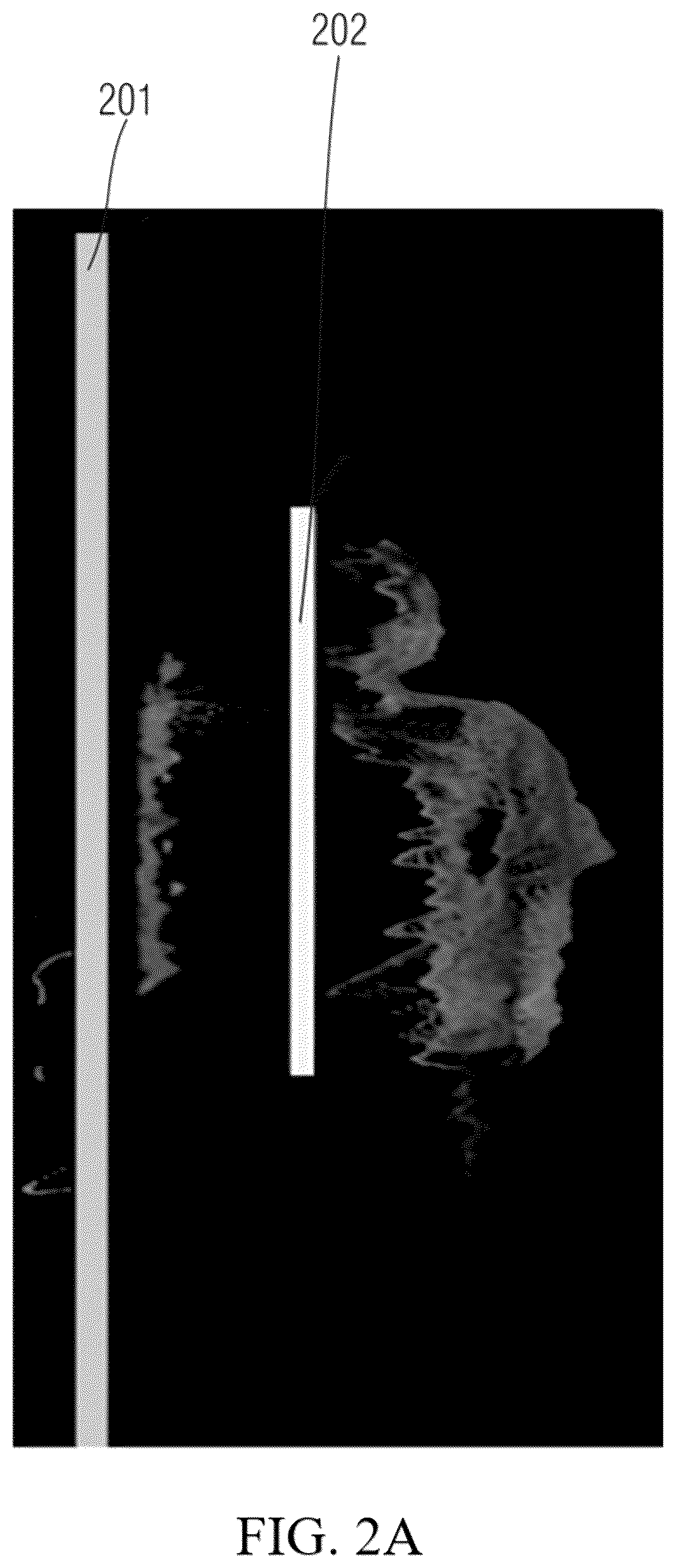 Patent US12599353 Figure 2 – Visualization of touch panel to object distance in X-ray imaging