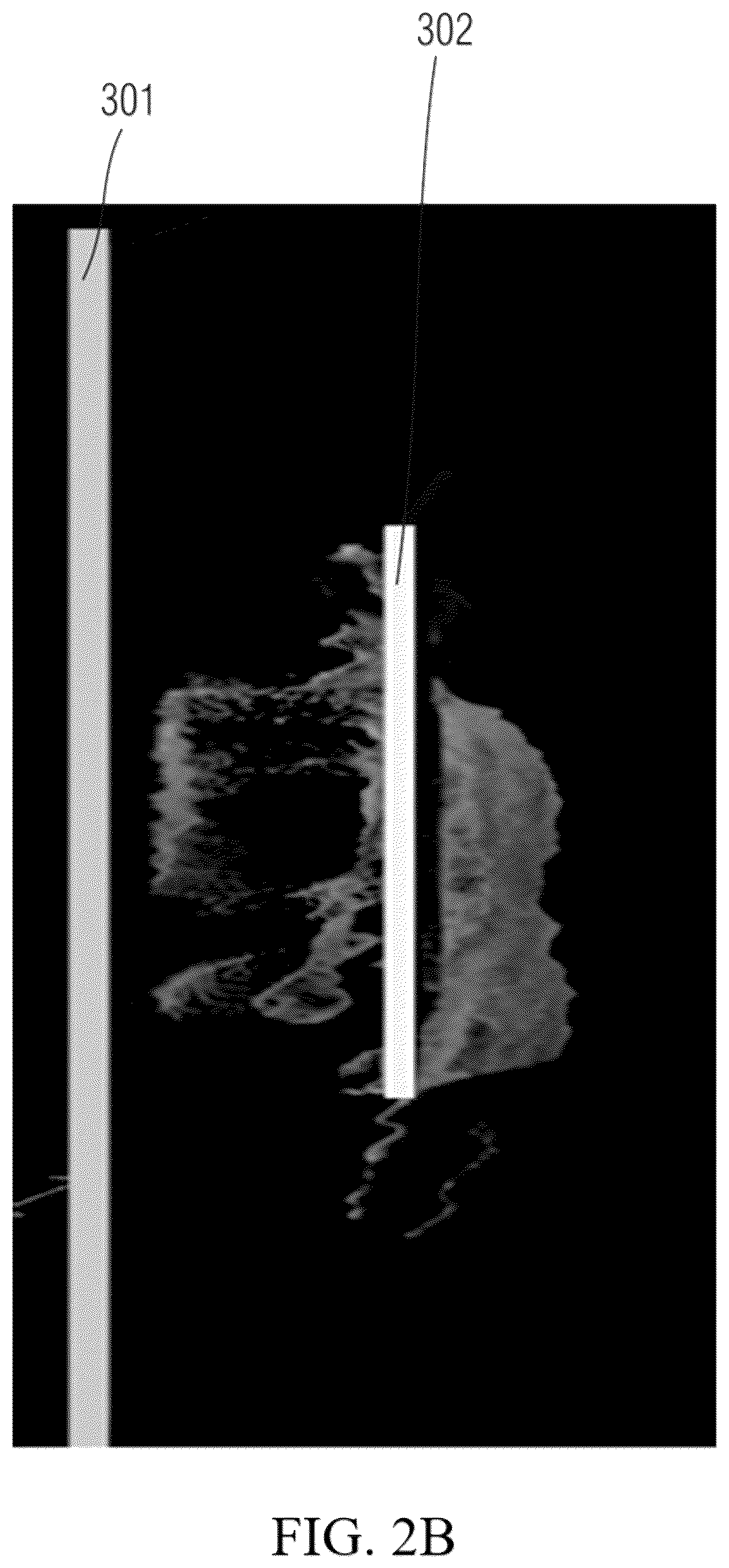 Patent US12599353 Figure 3 – Visualization of touch panel to object distance in X-ray imaging