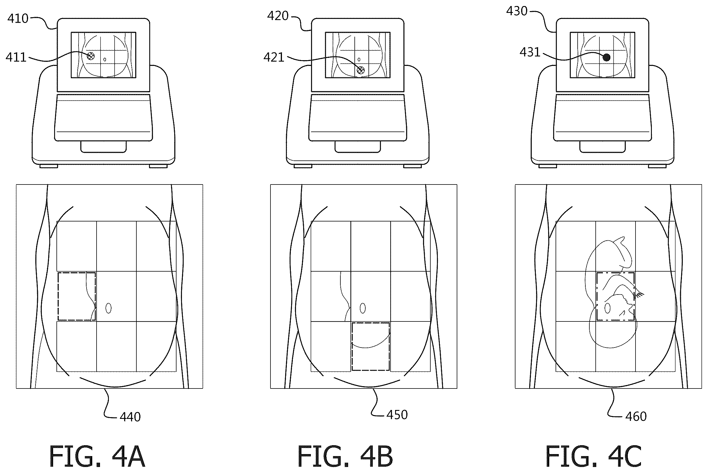 Patent US12599356 Figure 4 – Fetal heart rate monitoring
