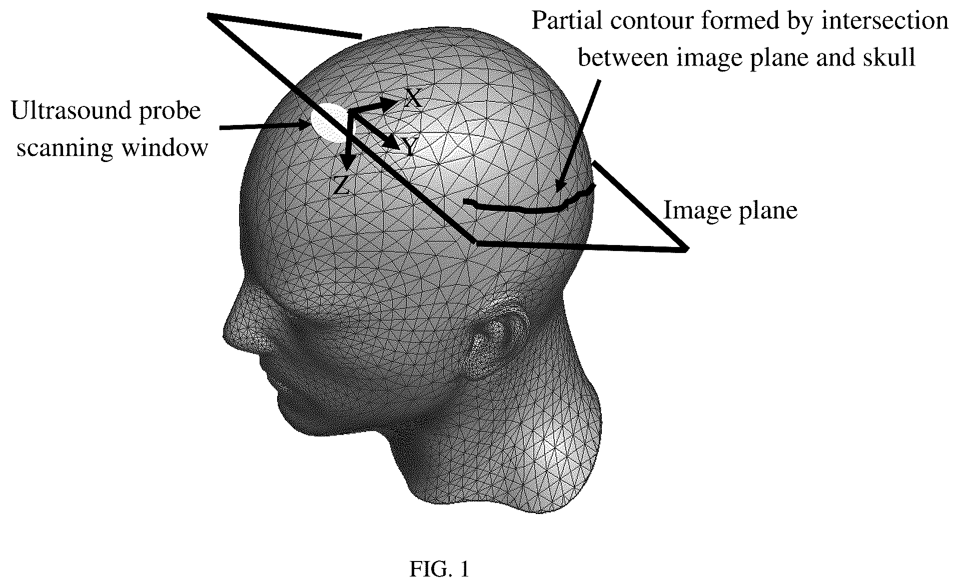 Patent US12599357 — Ultrasound automated detection and display method of cranial abnormal regions — Figure 1
