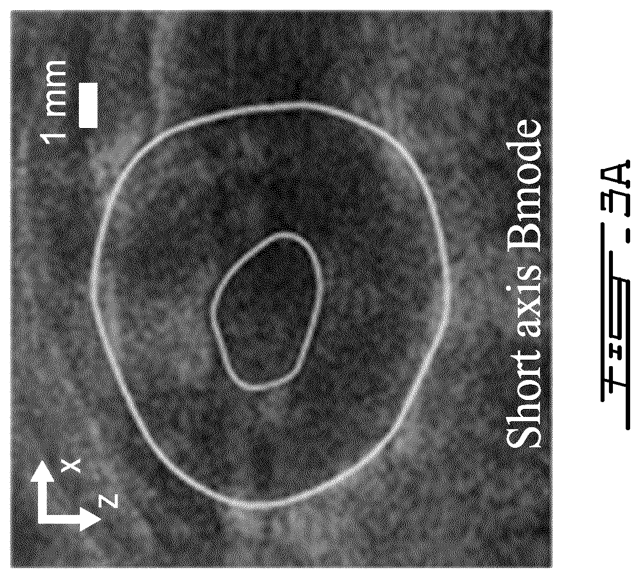 Patent US12599358 Figure 3 – Methods and systems for ultrasound imaging of a body in motion