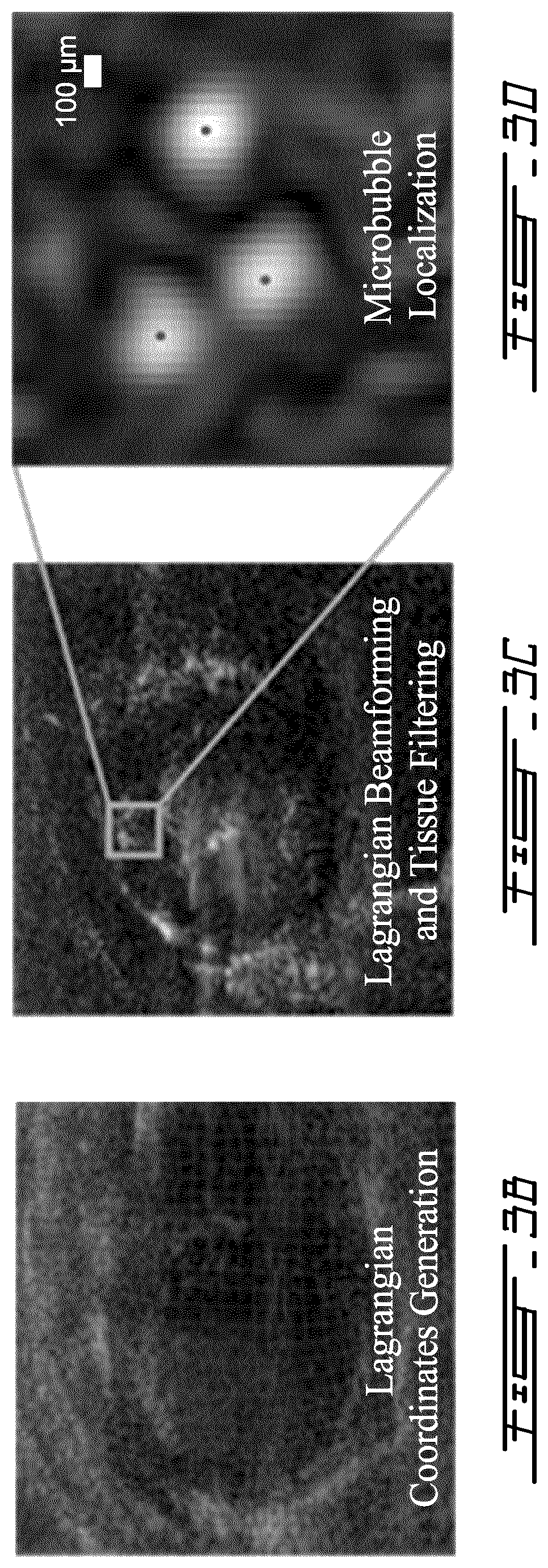 Patent US12599358 Figure 4 – Methods and systems for ultrasound imaging of a body in motion