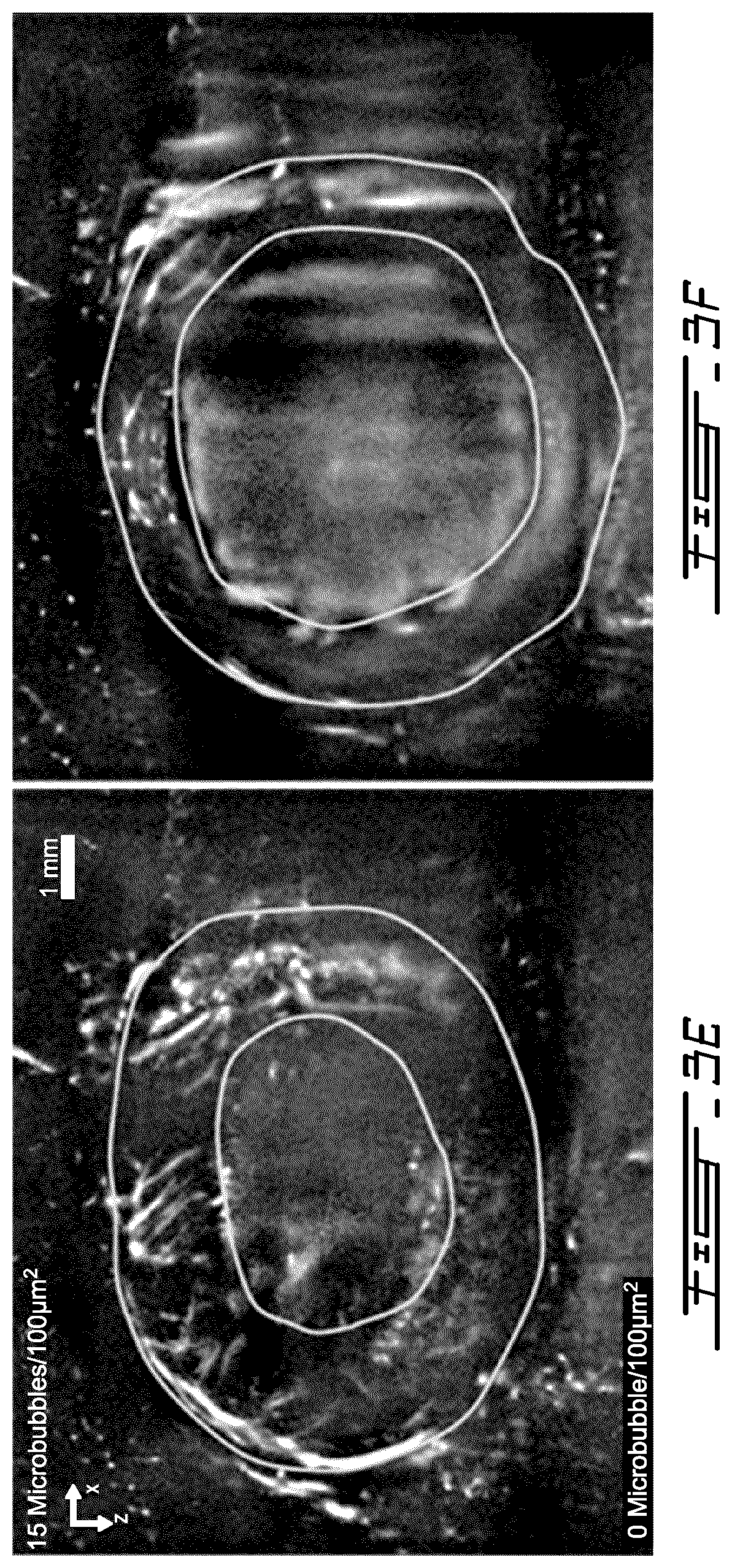 Patent US12599358 Figure 5 – Methods and systems for ultrasound imaging of a body in motion