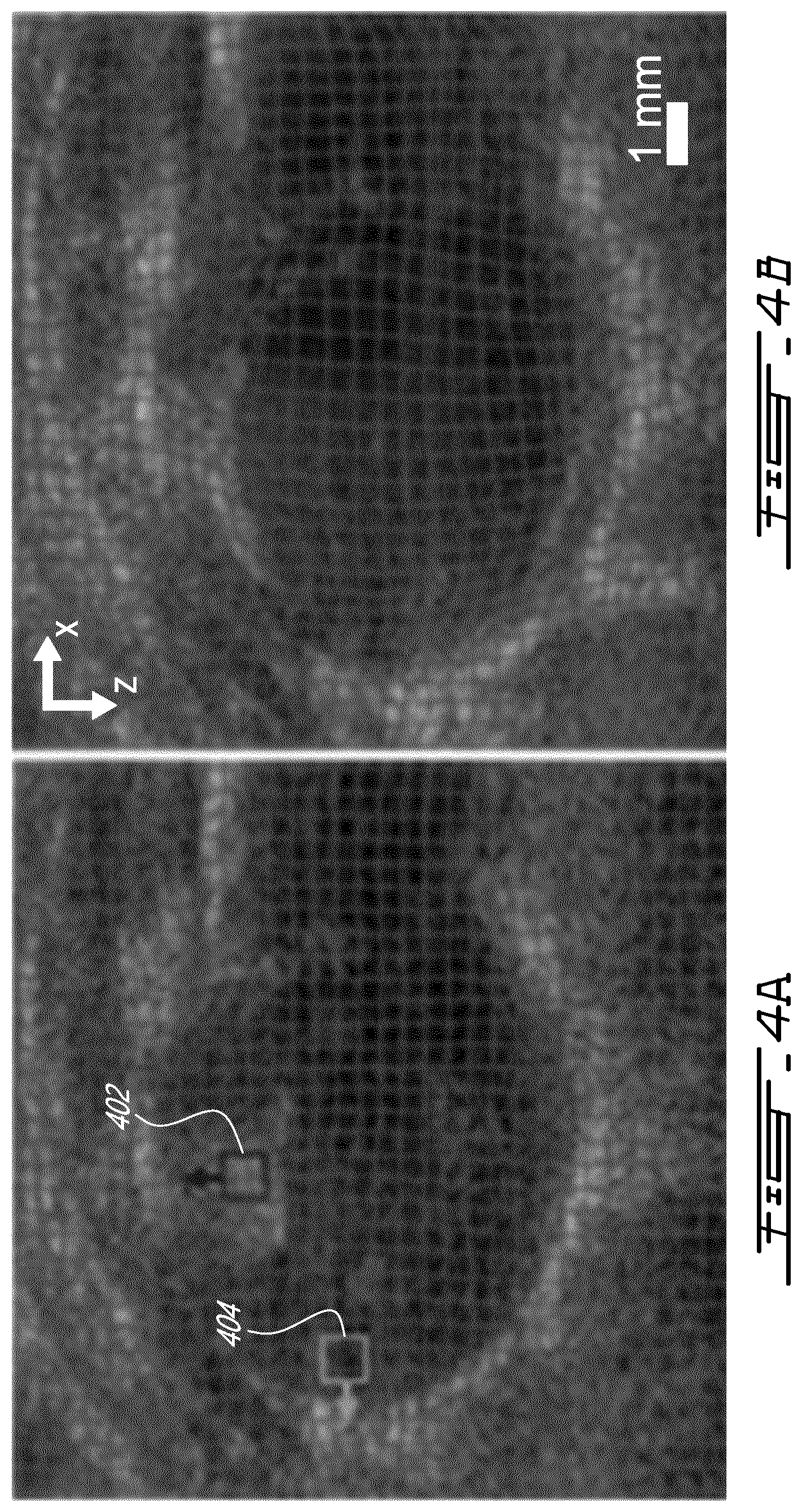 Patent US12599358 Figure 6 – Methods and systems for ultrasound imaging of a body in motion