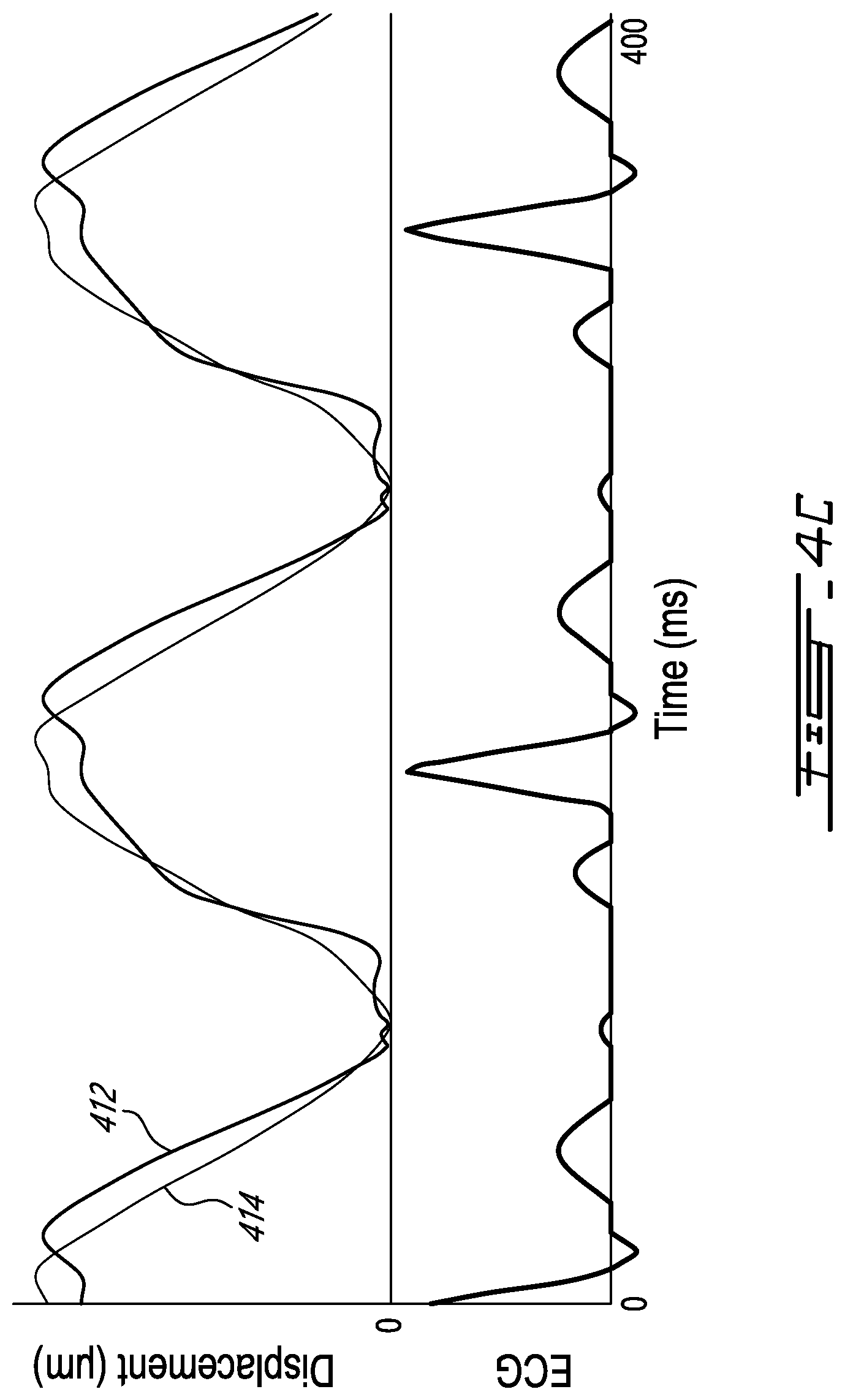 Patent US12599358 Figure 7 – Methods and systems for ultrasound imaging of a body in motion