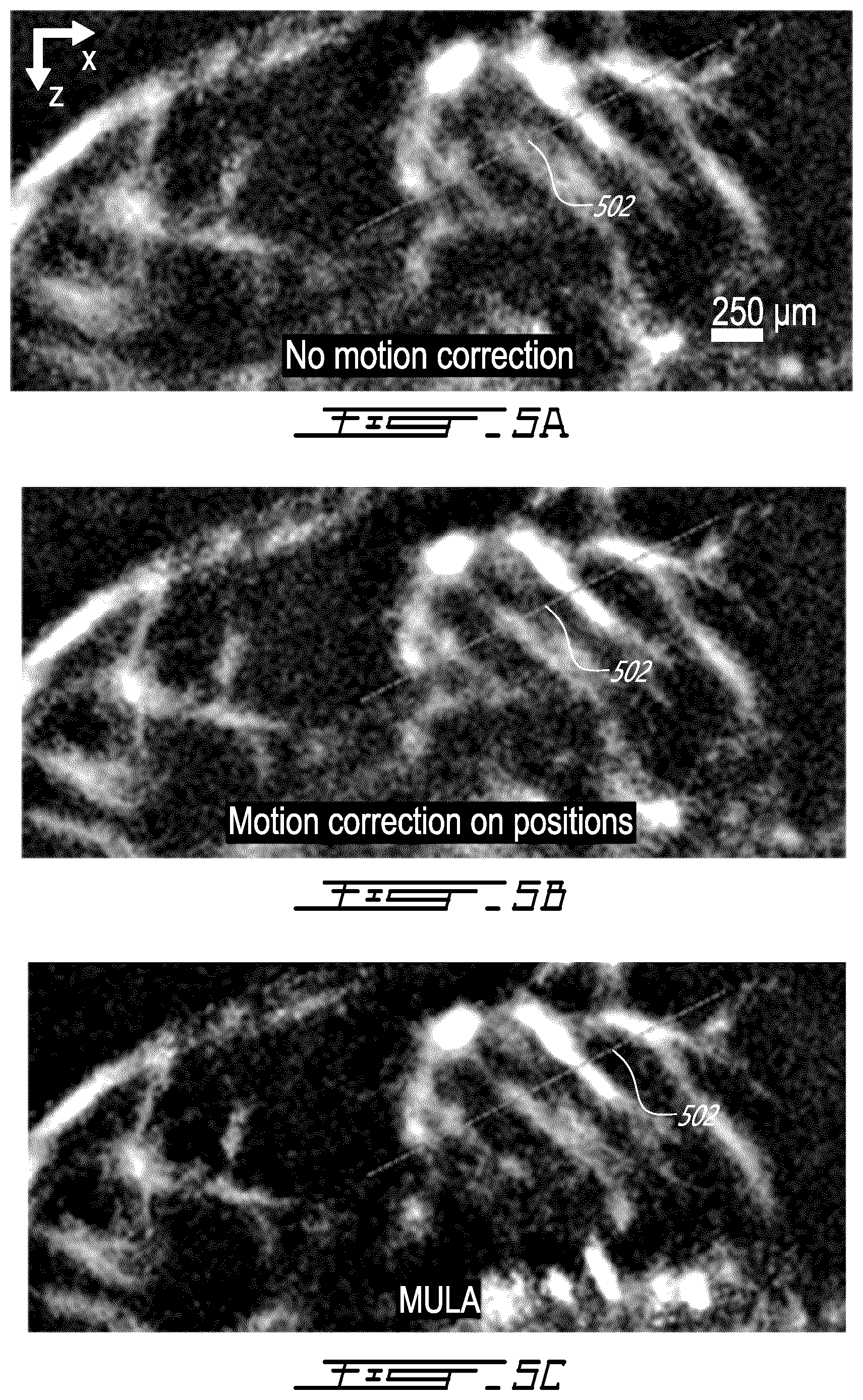 Patent US12599358 Figure 8 – Methods and systems for ultrasound imaging of a body in motion