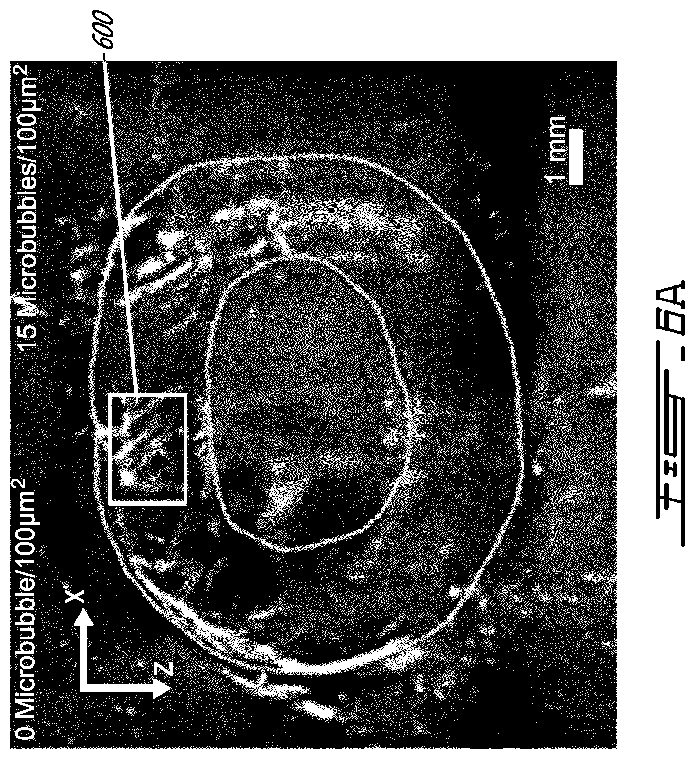 Patent US12599358 Figure 10 – Methods and systems for ultrasound imaging of a body in motion