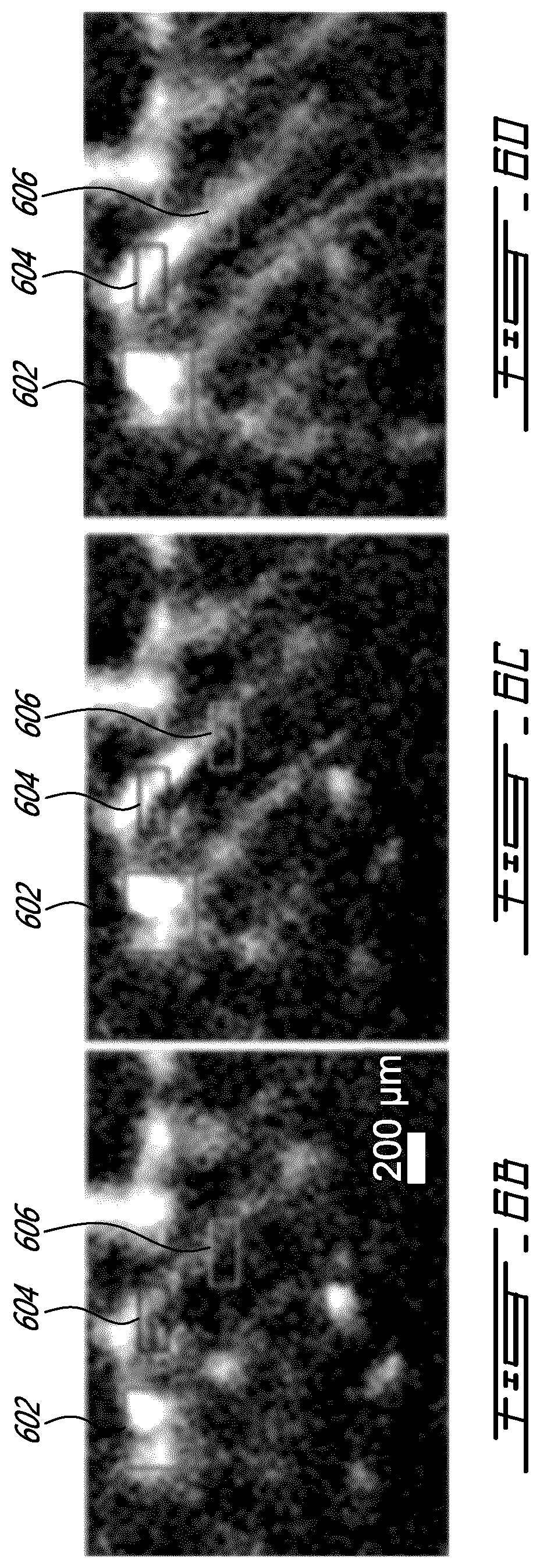 Patent US12599358 Figure 11 – Methods and systems for ultrasound imaging of a body in motion