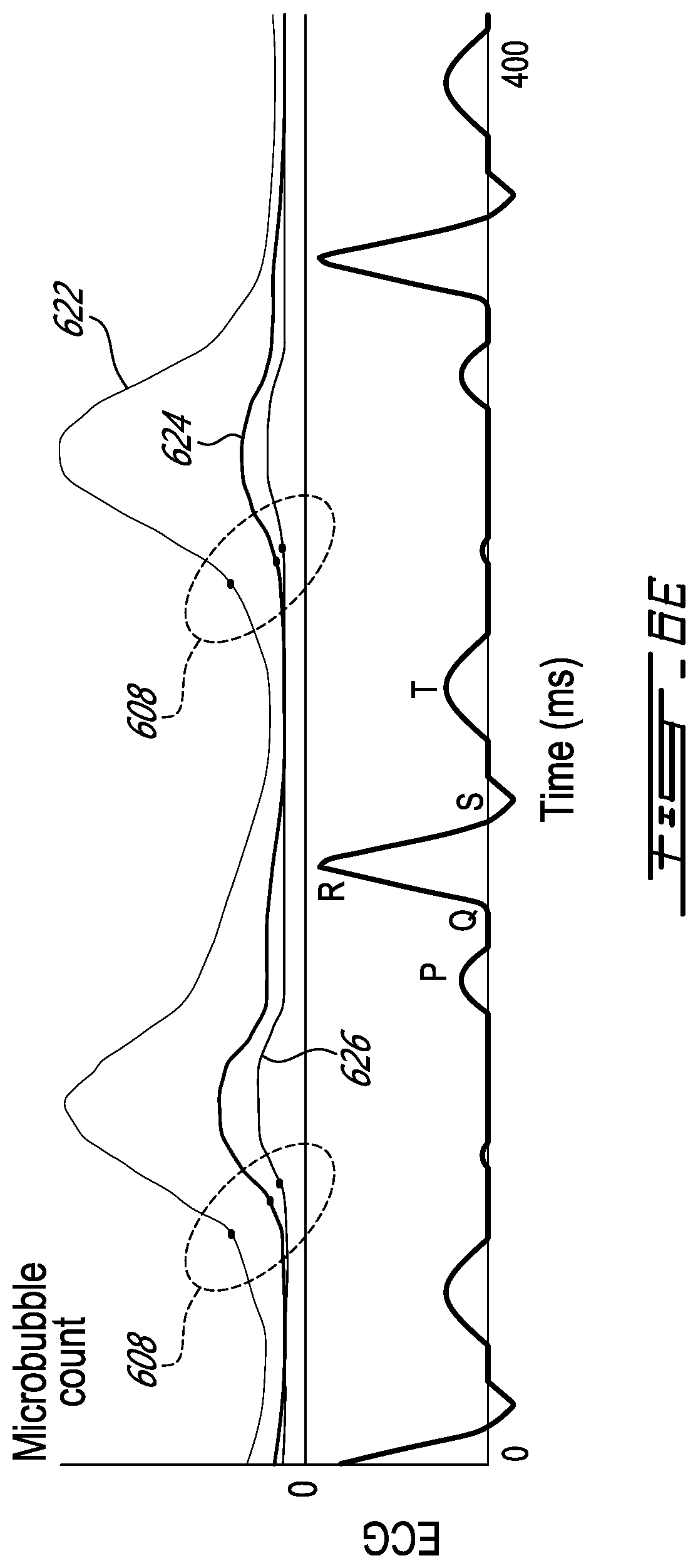 Patent US12599358 Figure 12 – Methods and systems for ultrasound imaging of a body in motion