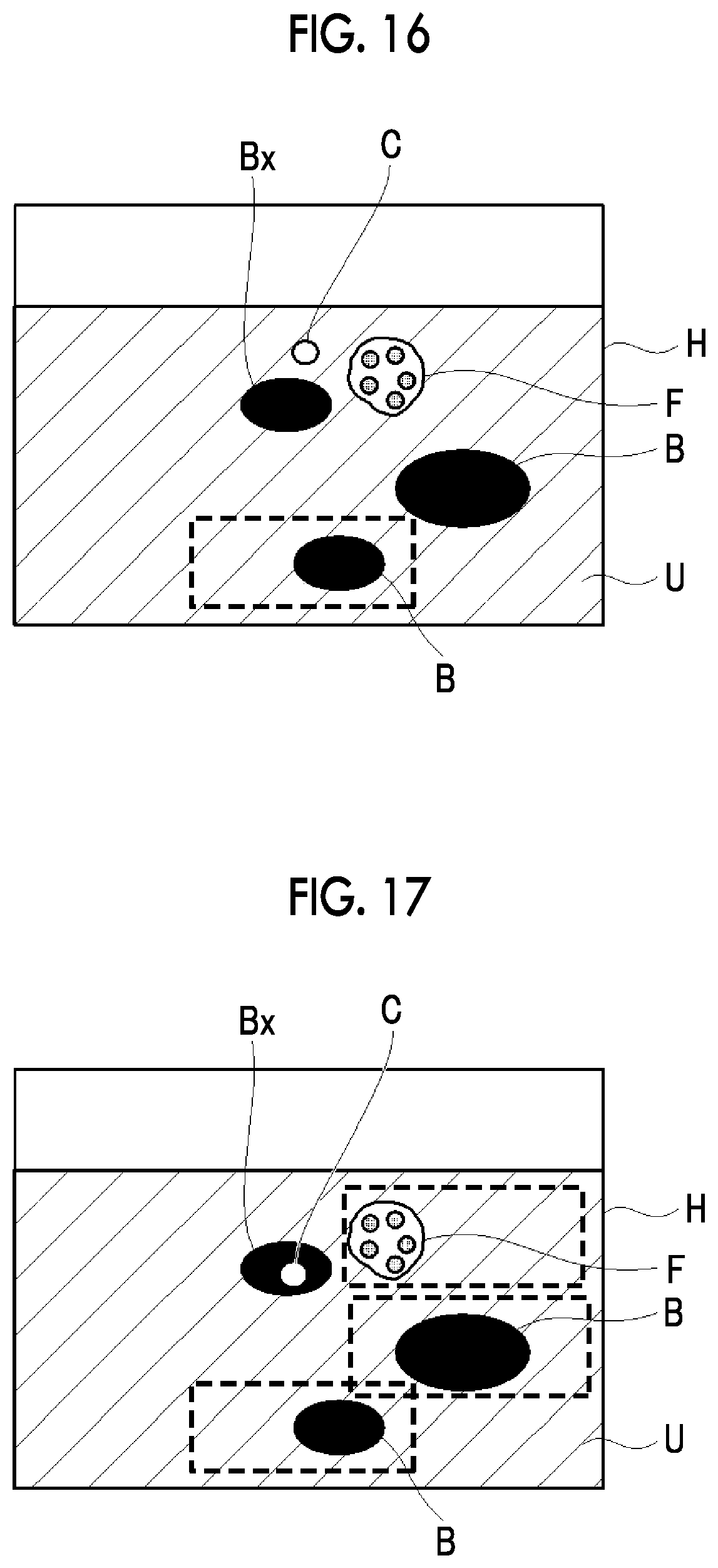 Patent US12599359 Figure 11 – Ultrasound diagnostic apparatus and method of controlling ultrasound diagnostic apparatus