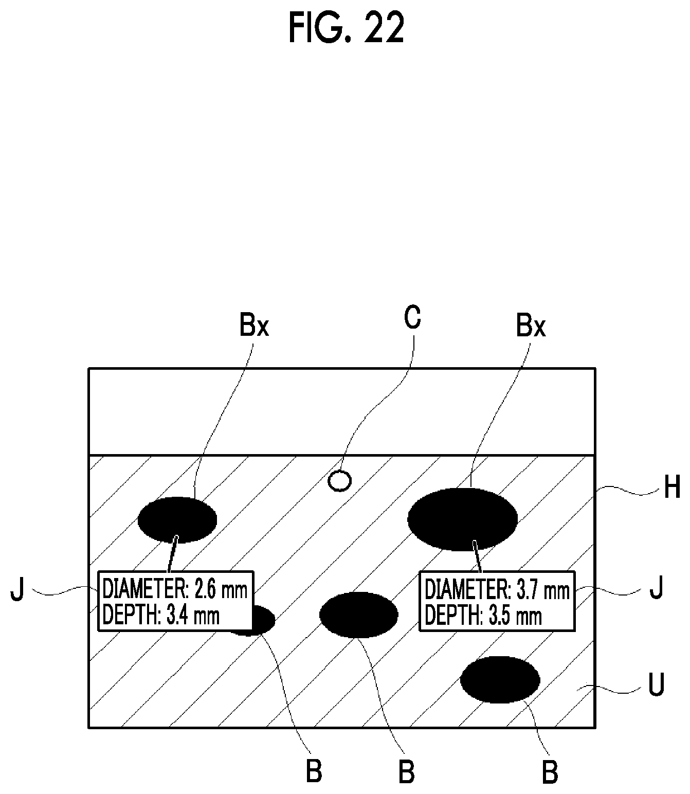 Patent US12599359 Figure 16 – Ultrasound diagnostic apparatus and method of controlling ultrasound diagnostic apparatus