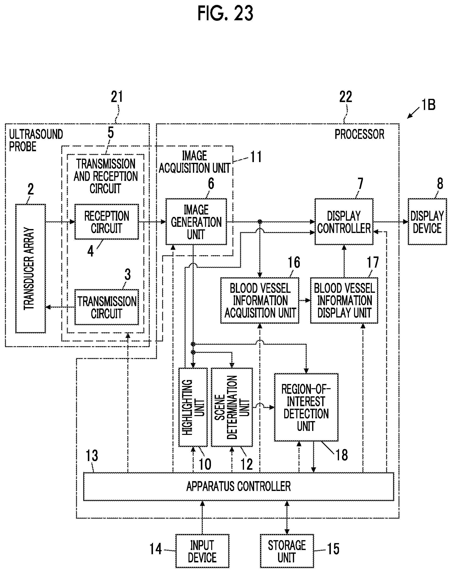 Patent US12599359 Figure 17 – Ultrasound diagnostic apparatus and method of controlling ultrasound diagnostic apparatus