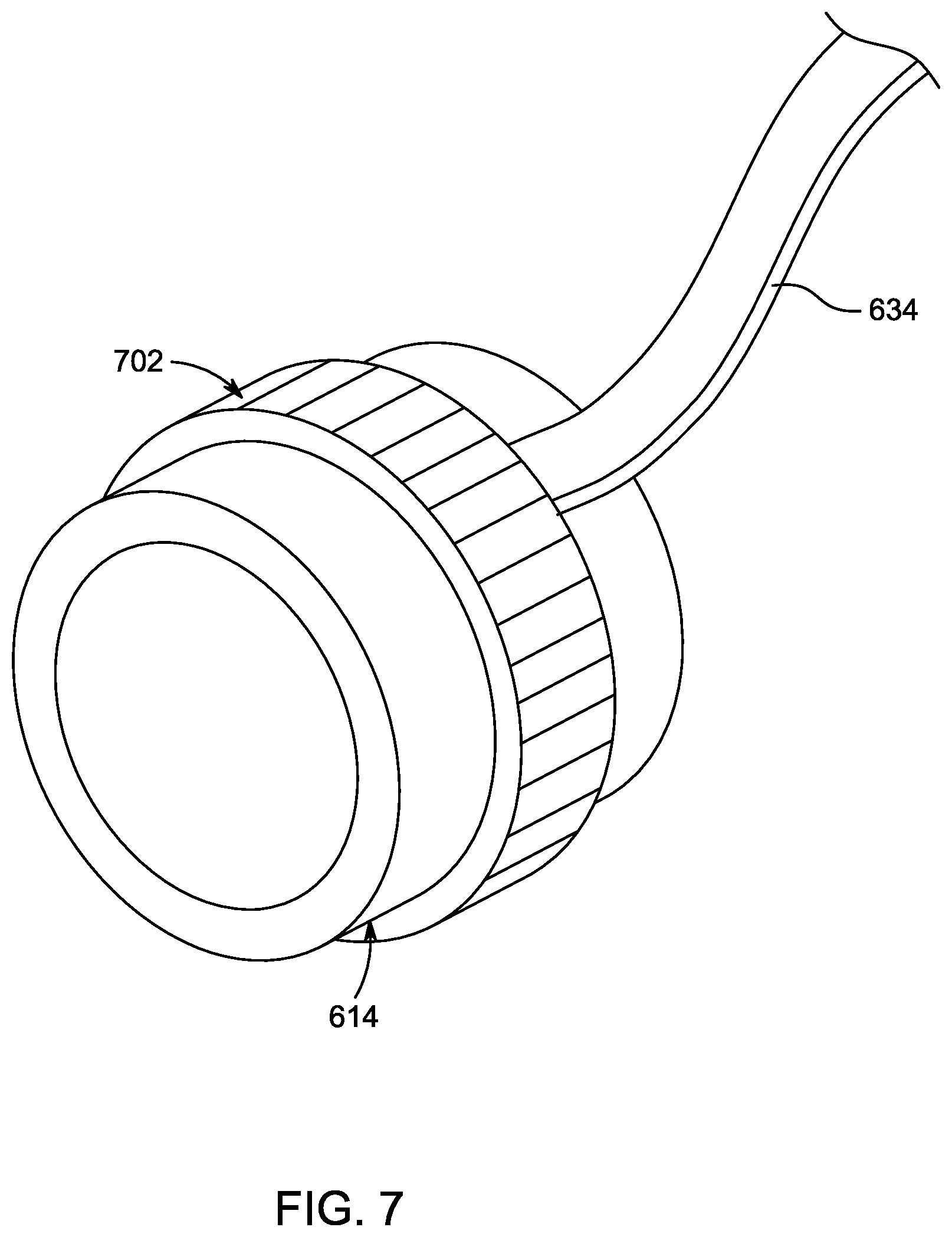 Patent US12599360 Figure 5 – Ultrasonic imaging ablation catheter system and method