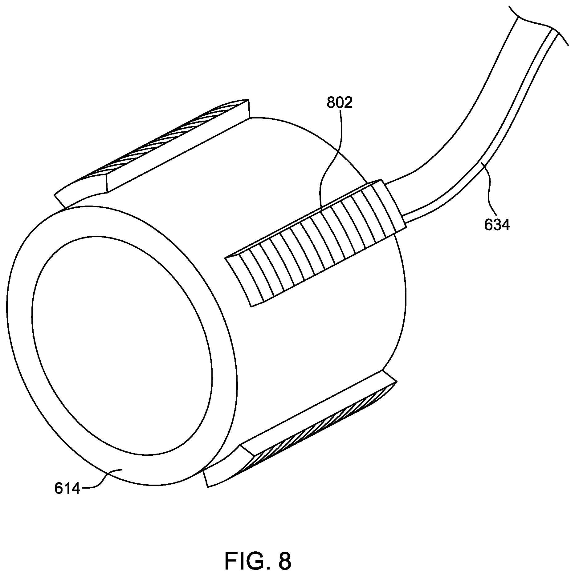 Patent US12599360 Figure 6 – Ultrasonic imaging ablation catheter system and method