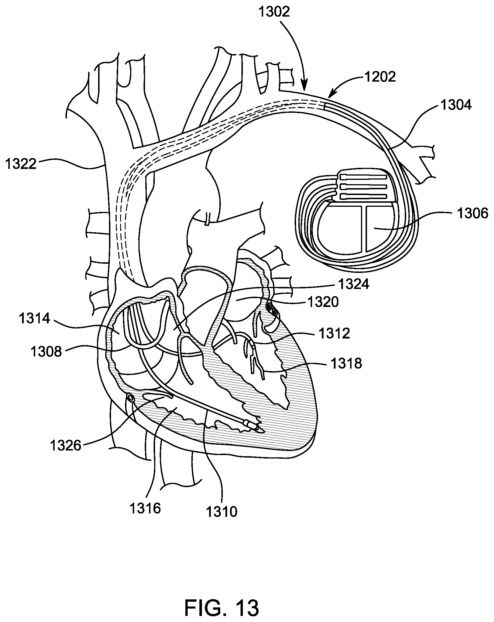 Patent US12599361 Figure 9 – Ultrasonic imaging system and method