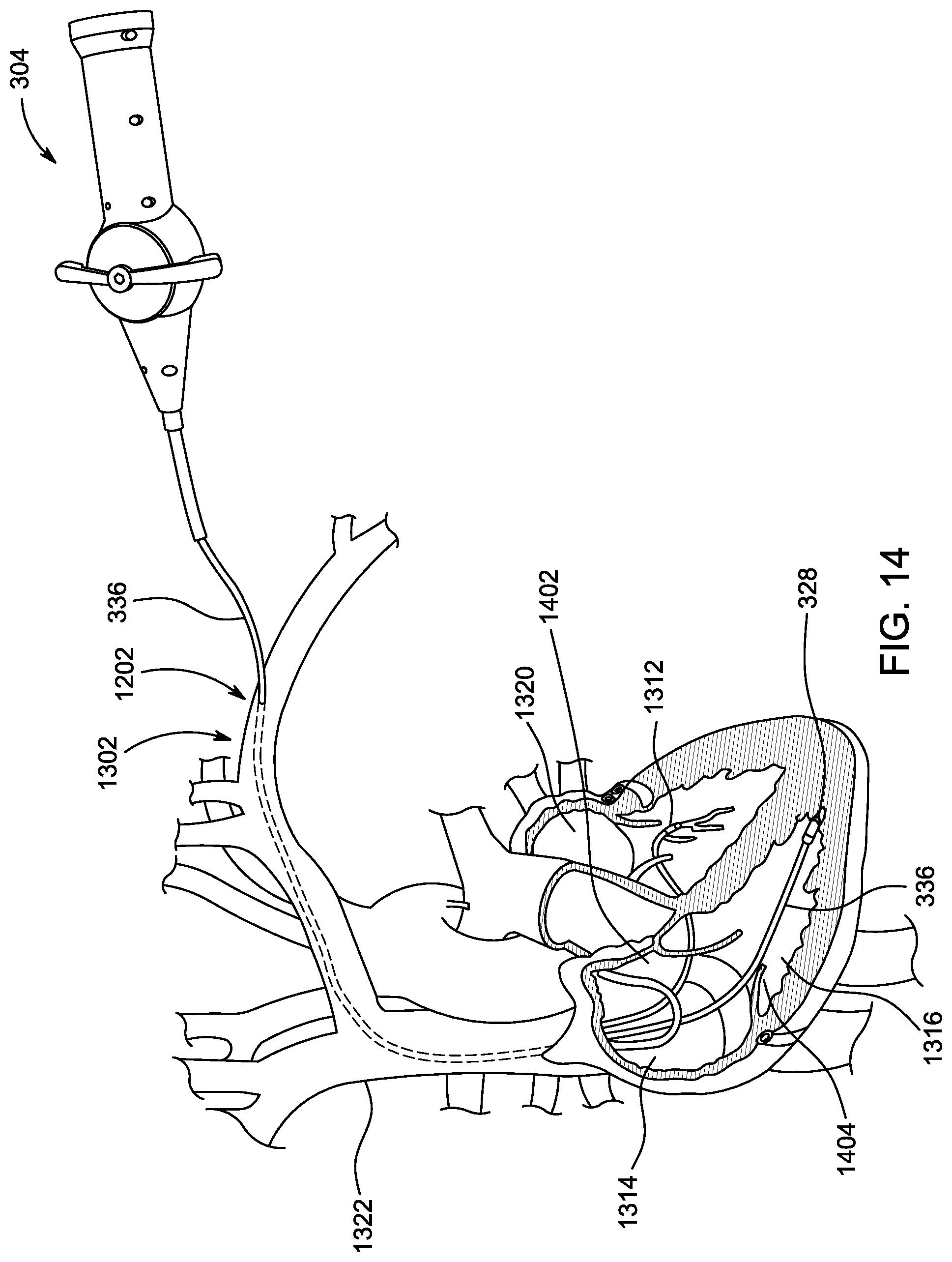 Patent US12599361 Figure 10 – Ultrasonic imaging system and method
