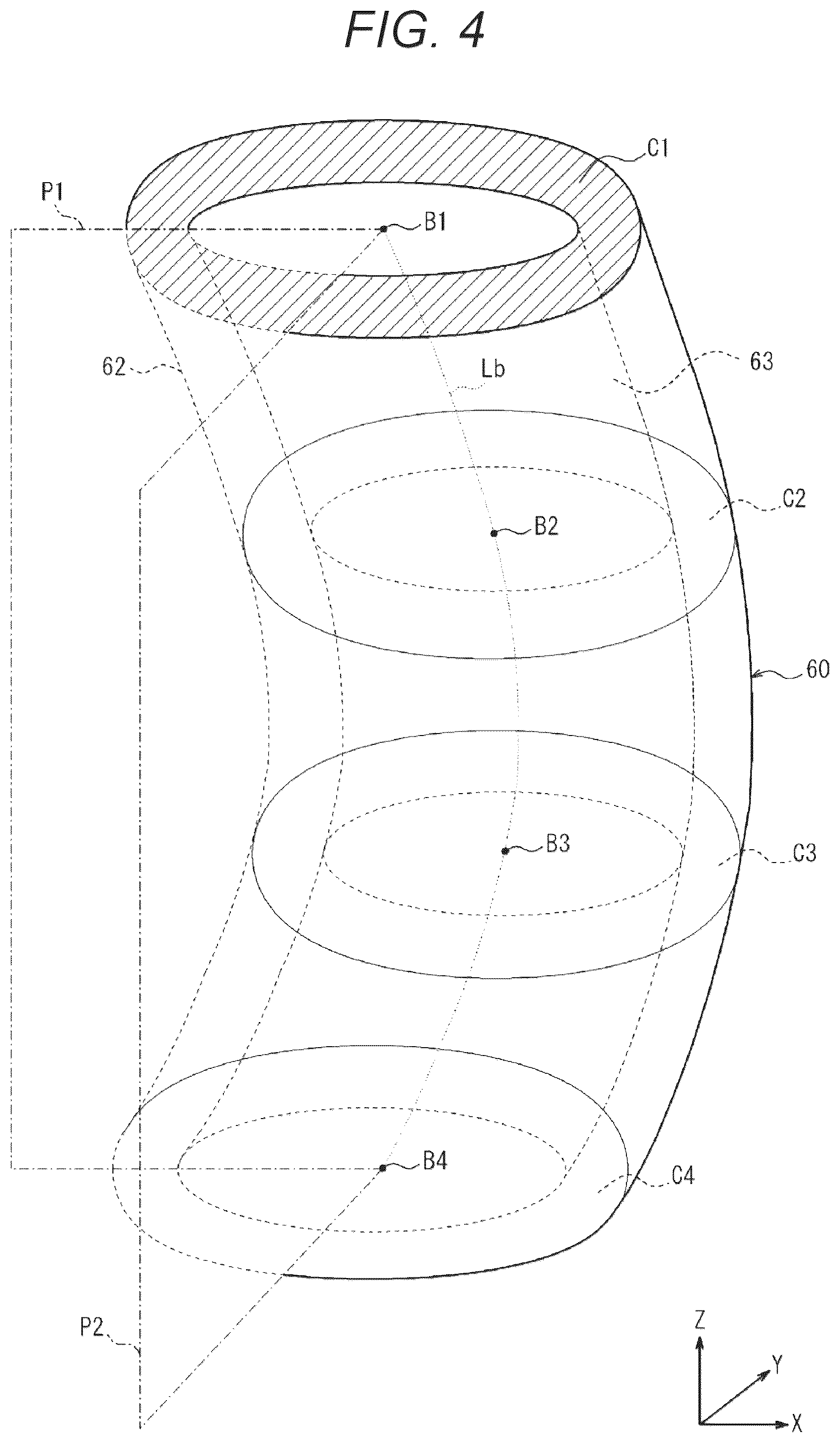Patent US12599362 Figure 4 – Image processing device, image processing system, image display method, and image processing program