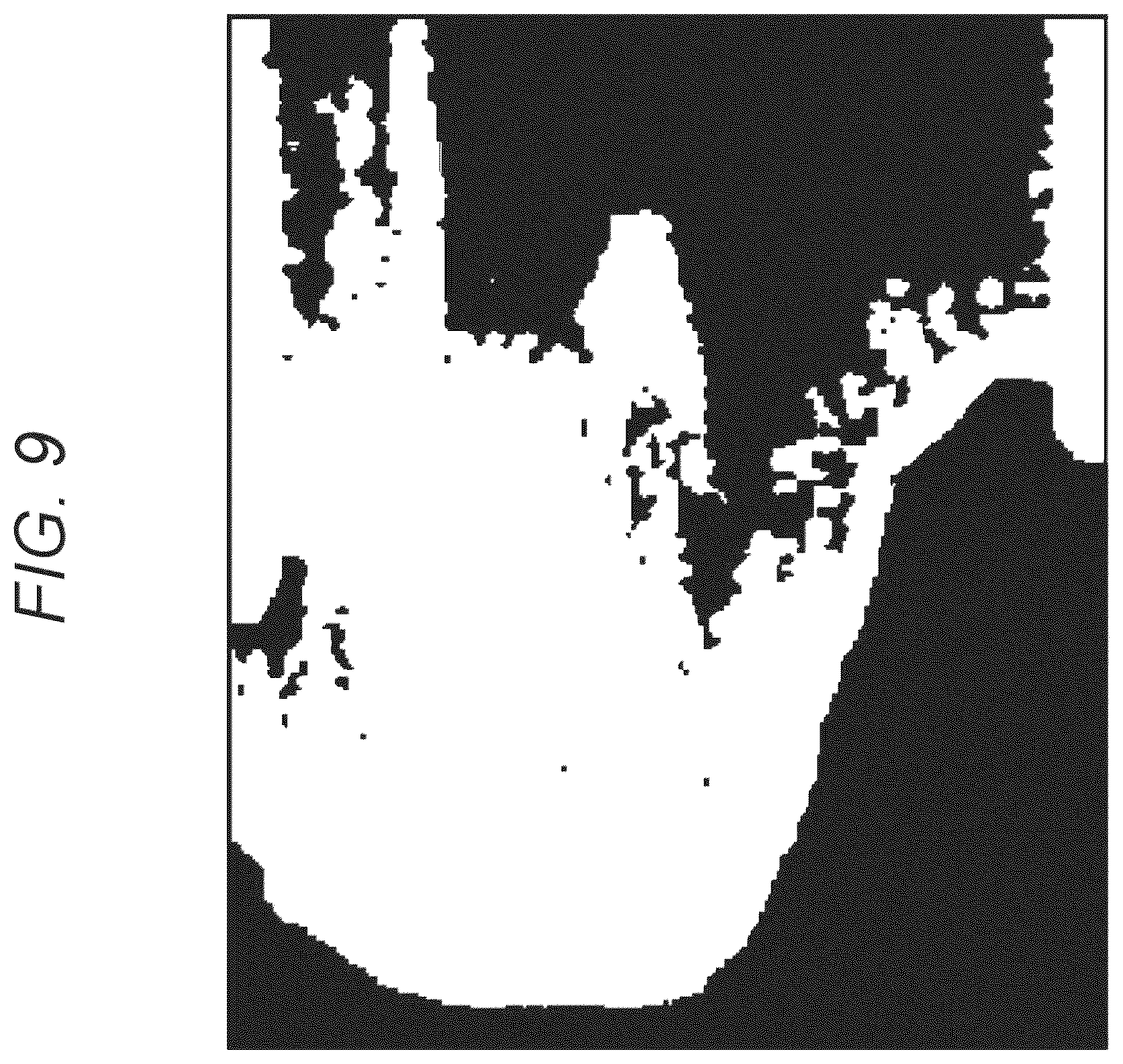 Patent US12599362 Figure 9 – Image processing device, image processing system, image display method, and image processing program