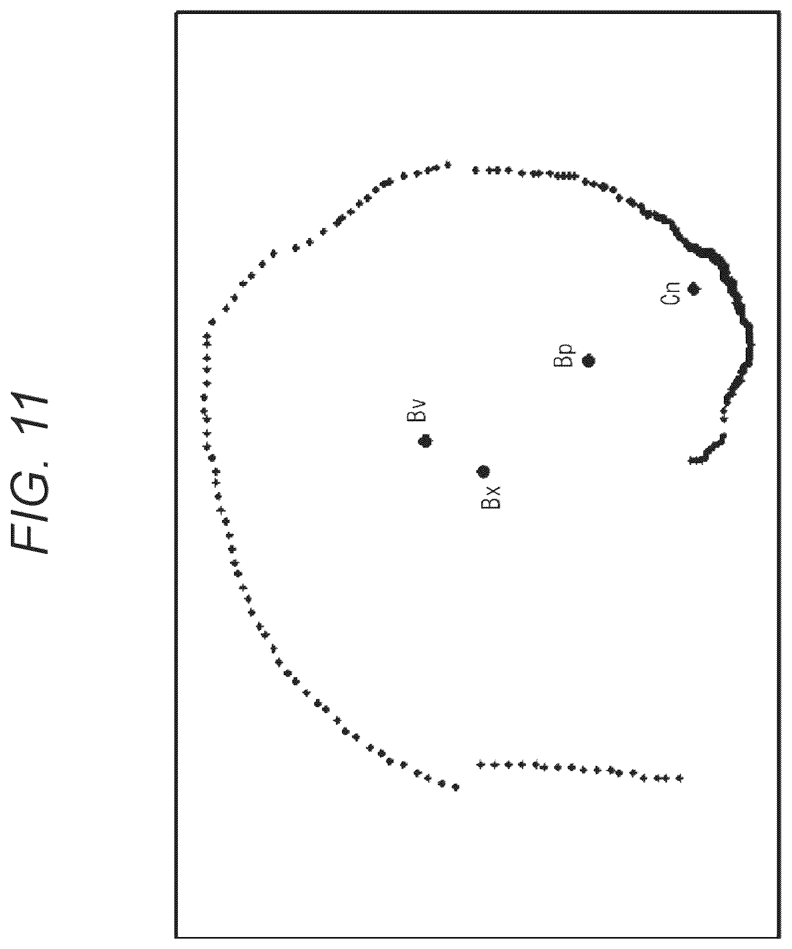 Patent US12599362 Figure 11 – Image processing device, image processing system, image display method, and image processing program