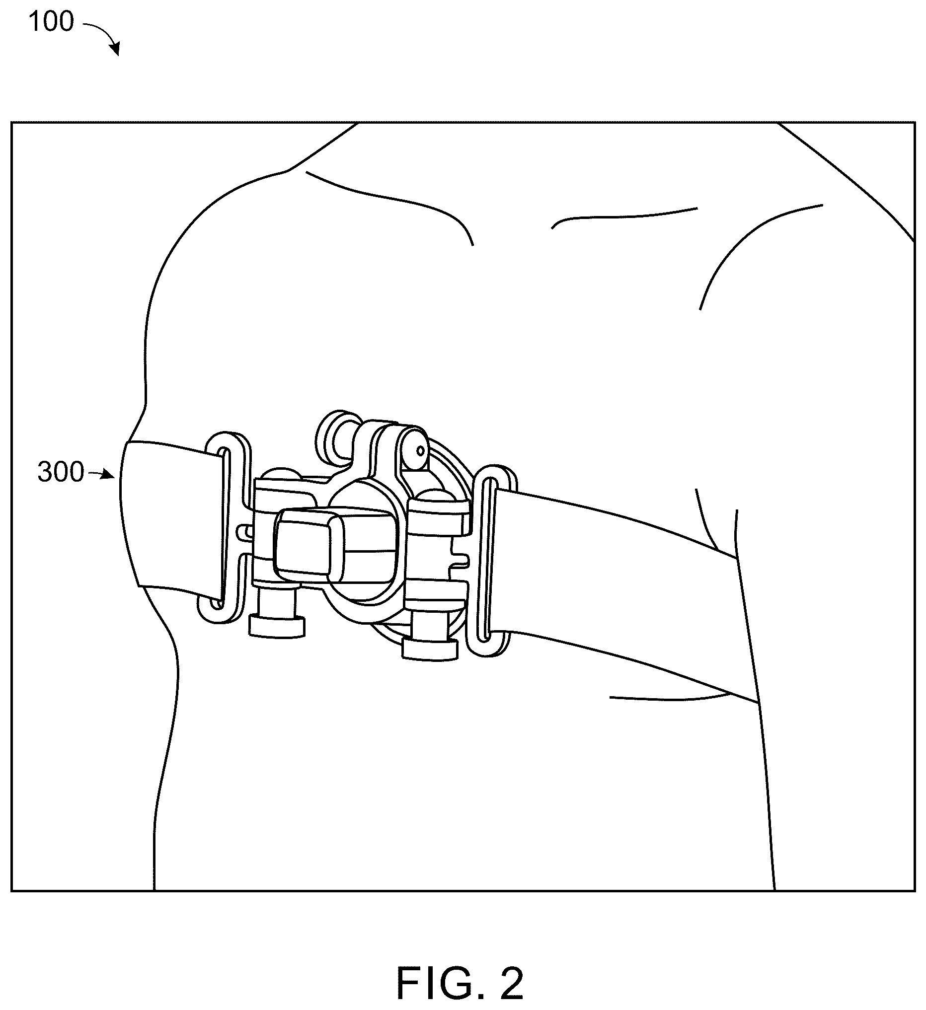 Patent US12599363 Figure 2 – Wearable device for hands-free operation of an ultrasound probe