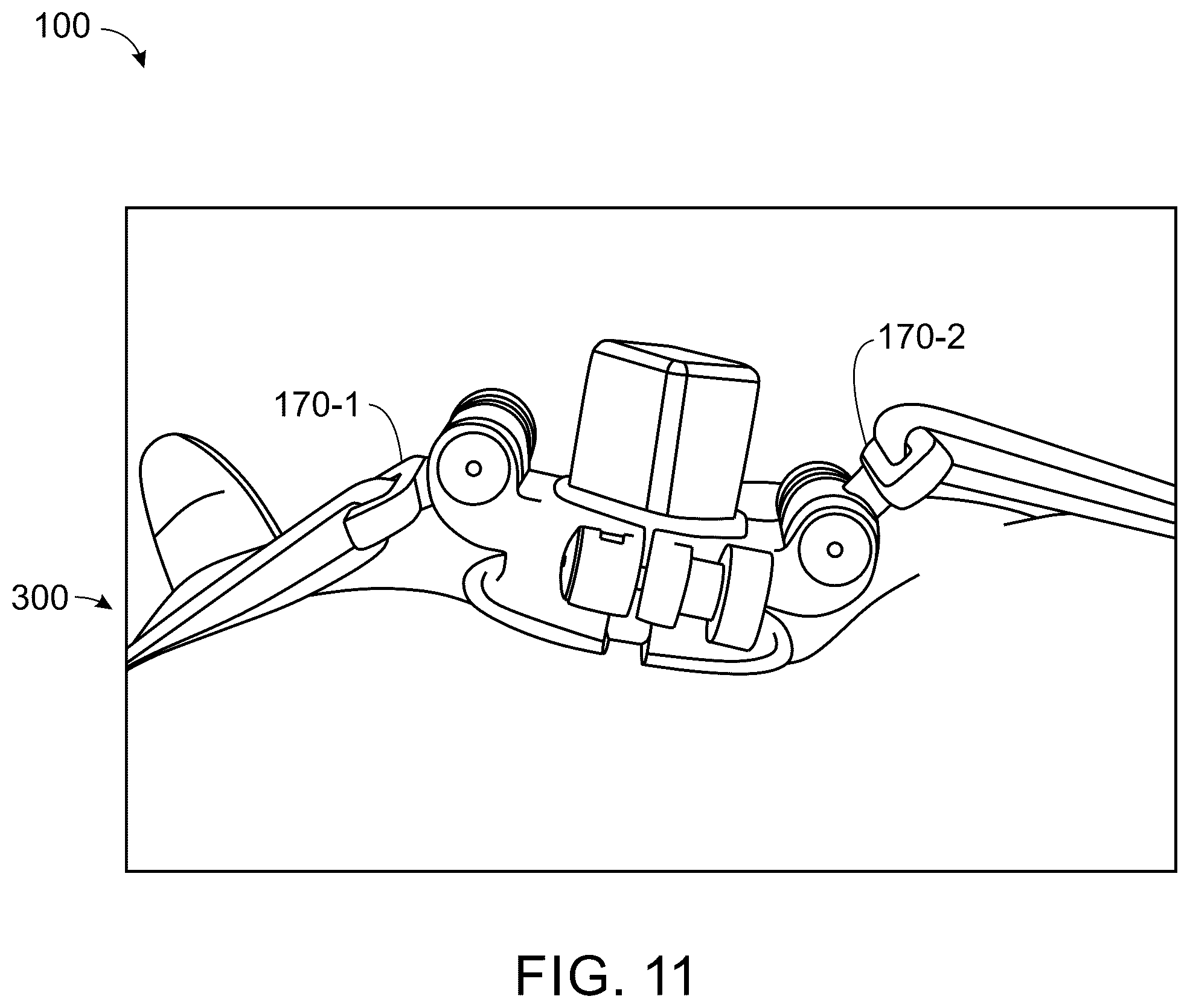Patent US12599363 Figure 11 – Wearable device for hands-free operation of an ultrasound probe