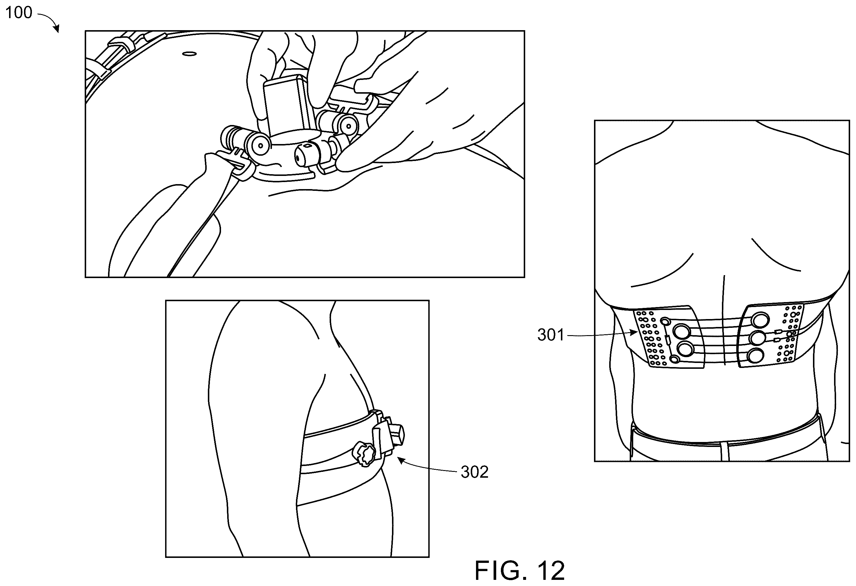 Patent US12599363 Figure 12 – Wearable device for hands-free operation of an ultrasound probe