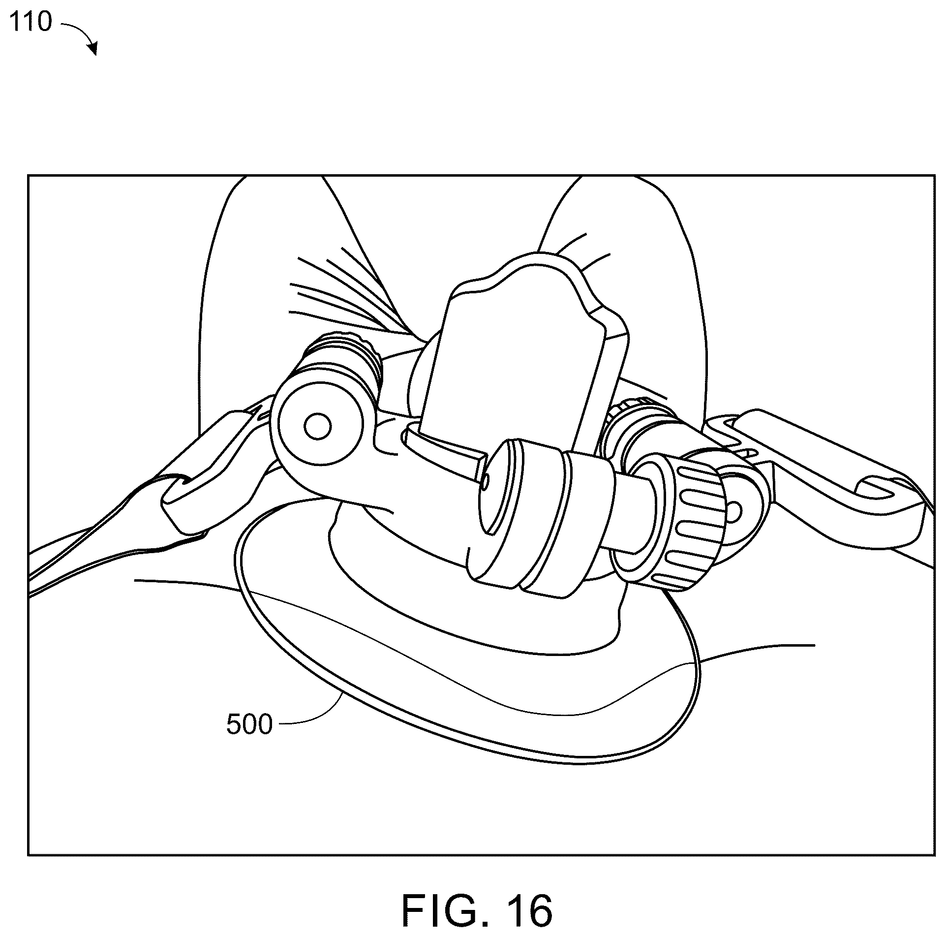 Patent US12599363 Figure 16 – Wearable device for hands-free operation of an ultrasound probe