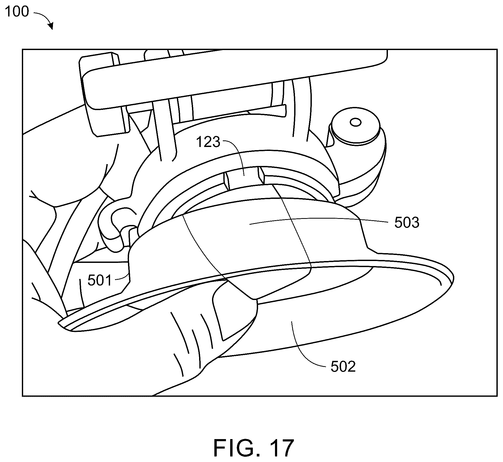 Patent US12599363 Figure 17 – Wearable device for hands-free operation of an ultrasound probe