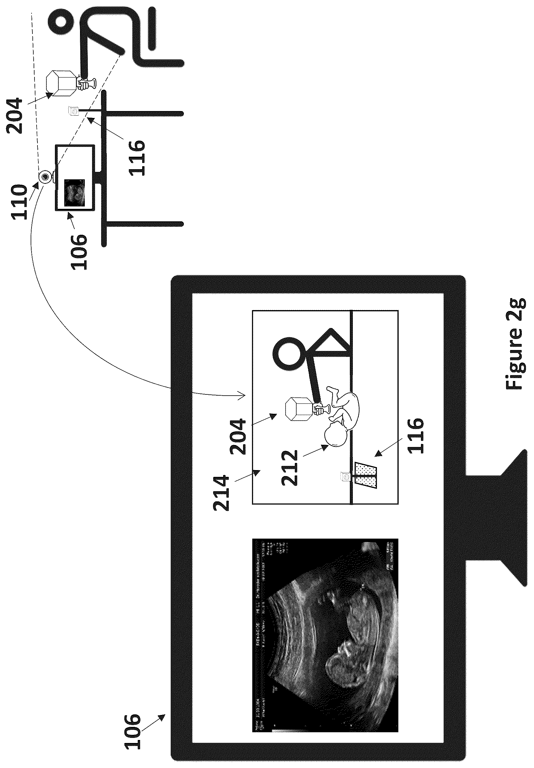Patent US12599364 Figure 6 – Ultrasound simulation system