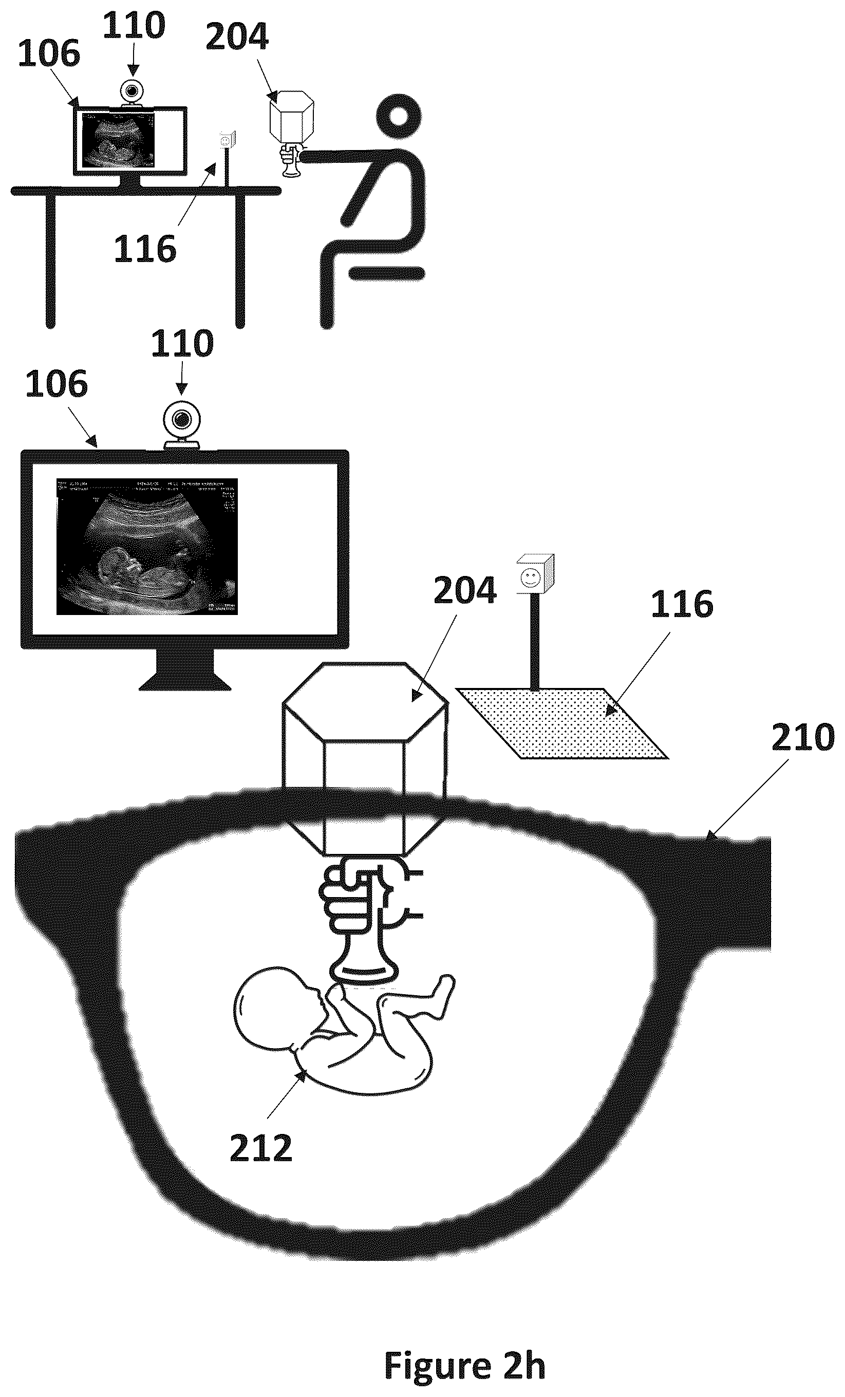 Patent US12599364 Figure 7 – Ultrasound simulation system