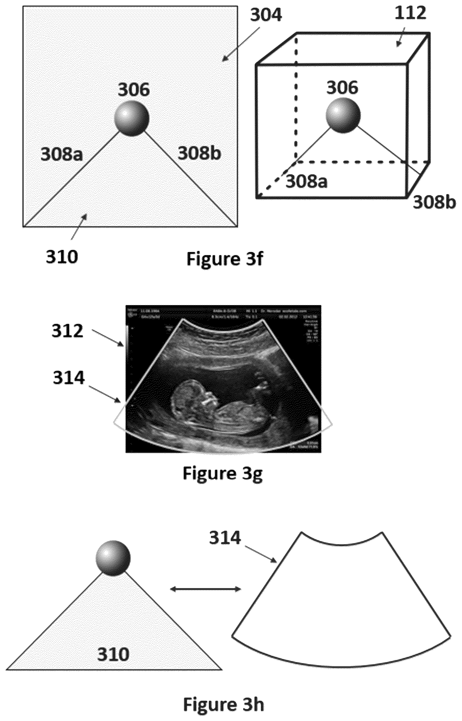 Patent US12599364 Figure 12 – Ultrasound simulation system