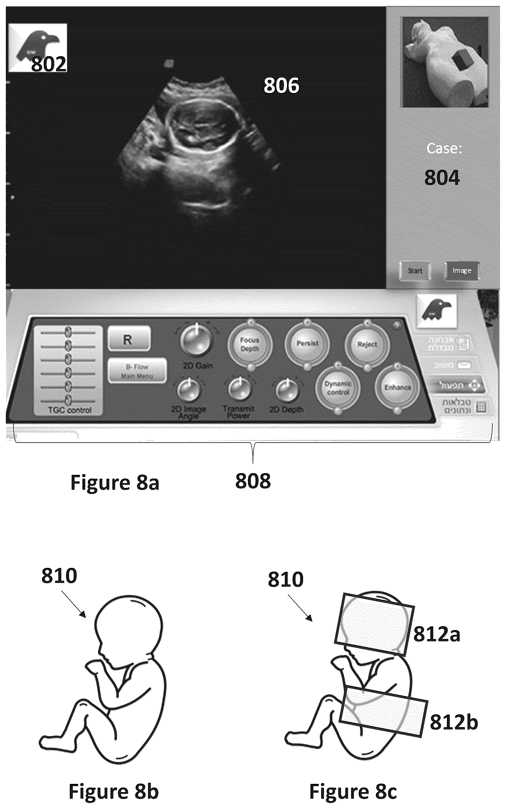 Patent US12599364 Figure 19 – Ultrasound simulation system