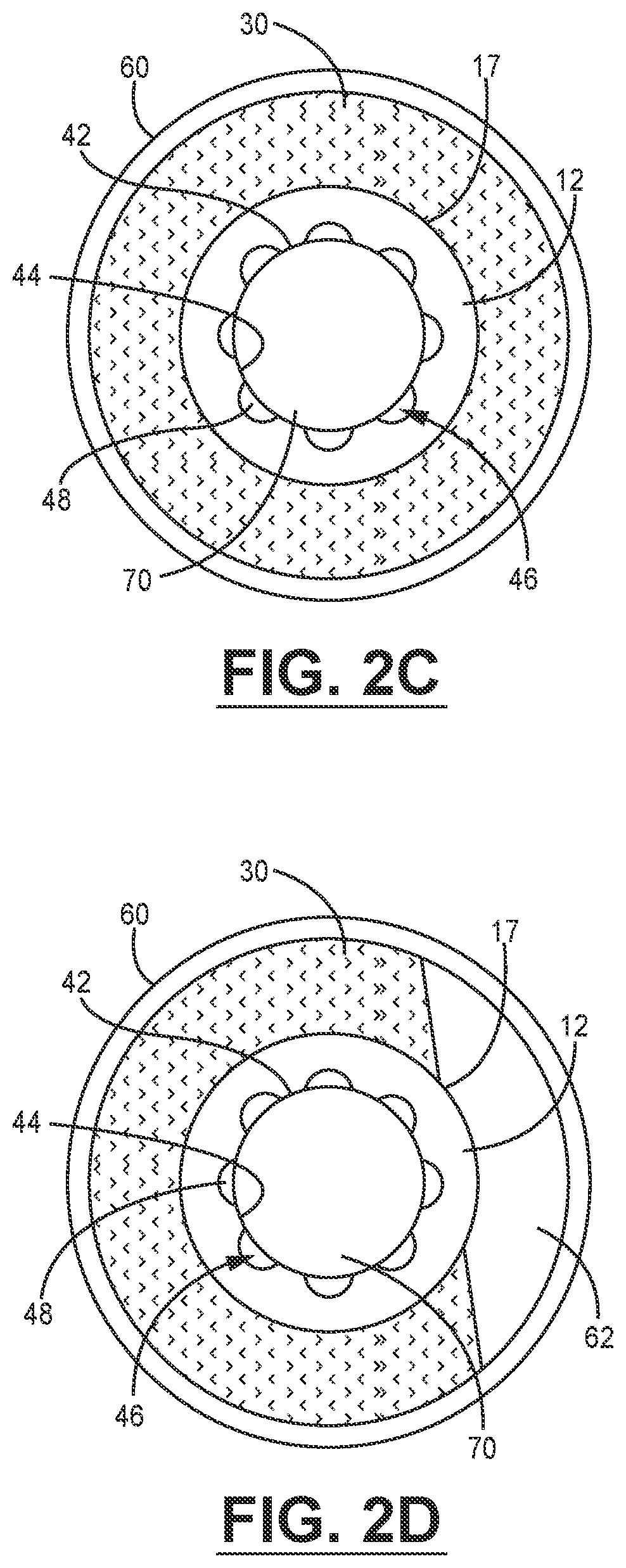 Patent US12599365 Figure 3 – Stabilizing transnasal balloon sheath