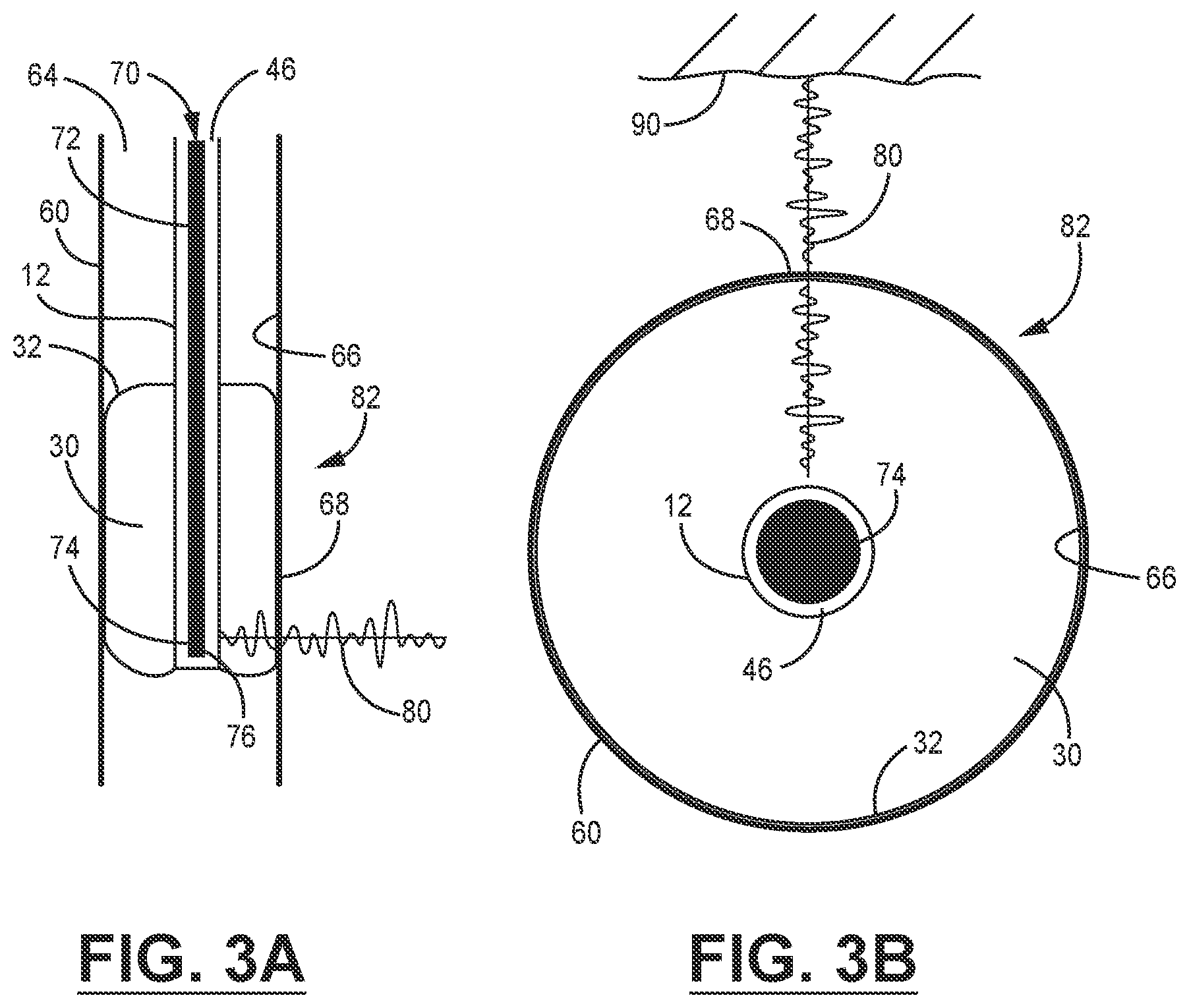 Patent US12599365 Figure 4 – Stabilizing transnasal balloon sheath