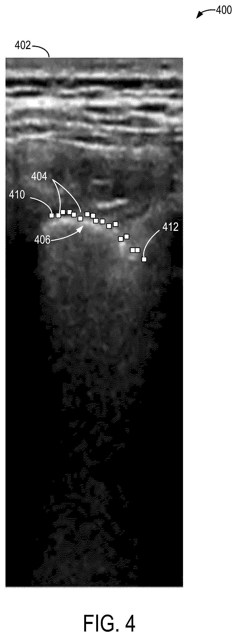 Patent US12599367 Figure 4 – Methods and systems for generating 3D pleural surfaces